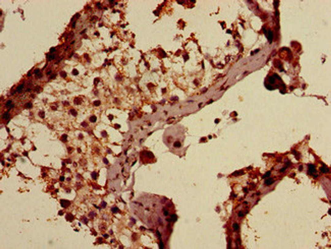 Immunohistochemistry of paraffin-embedded human testis tissue using CSB-PA001868ED01HU at dilution of 1:100