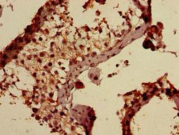 Immunohistochemistry of paraffin-embedded human testis tissue using CSB-PA001868ED01HU at dilution of 1:100