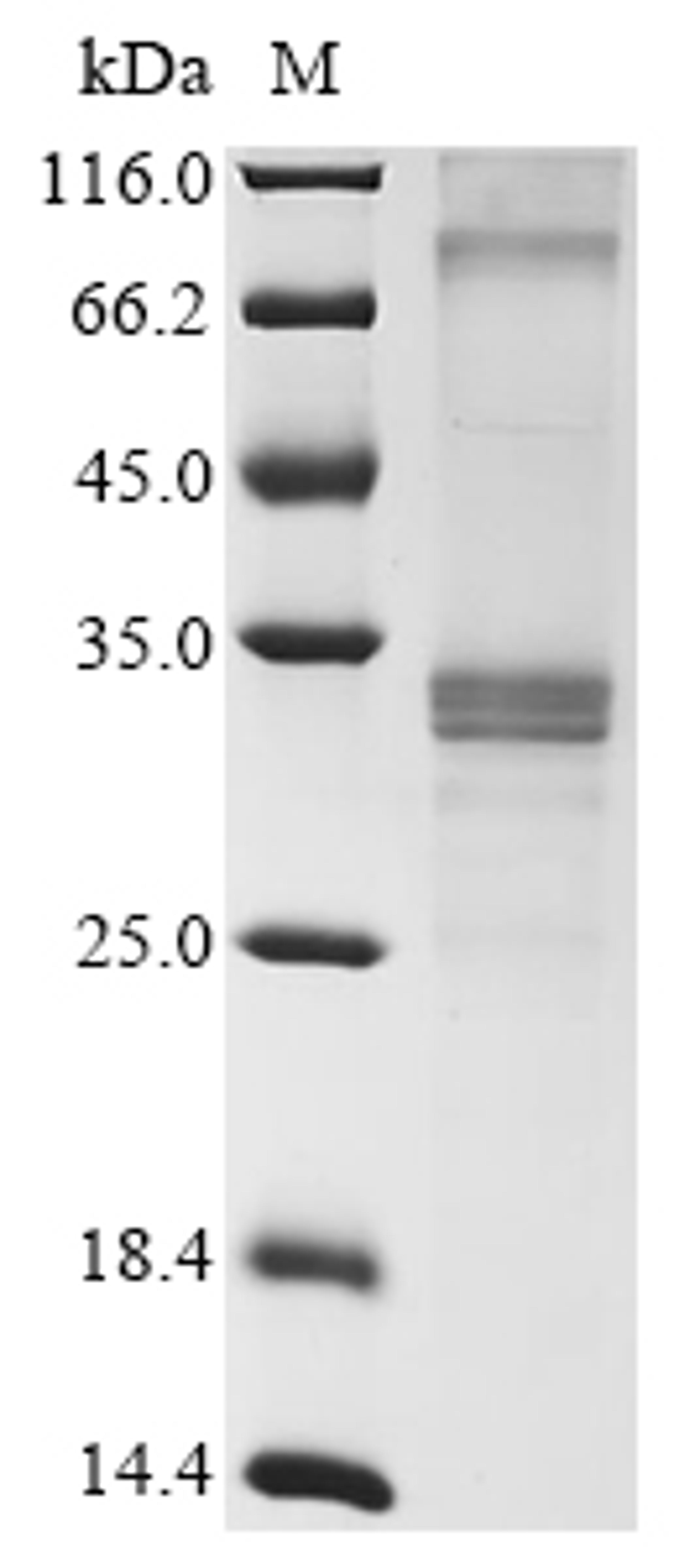 (Tris-Glycine gel) Discontinuous SDS-PAGE (reduced) with 5% enrichment gel and 15% separation gel.