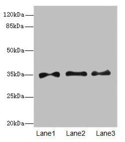 Western blot. All lanes: PRPS1antibody at 6.28ug/ml. Lane 1: HepG2 whole cell lysate. Lane 2: Jurkat whole cell lysate. Lane 3: 293T whole cell lysate. Secondary. Goat polyclonal to rabbit IgG at 1/10000 dilution. Predicted band size: 35, 28 kDa. Observed band size: 35 kDa. 