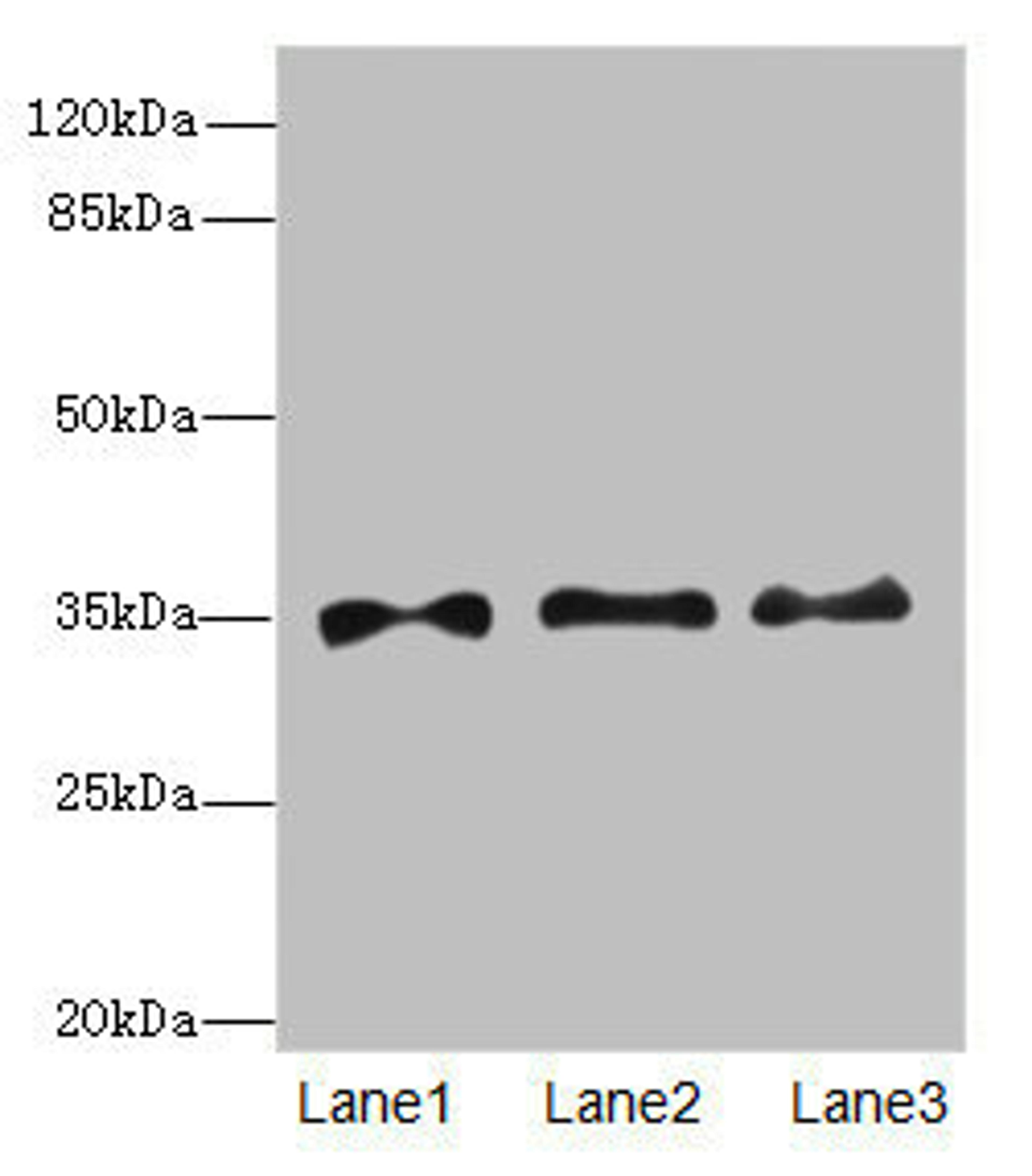 Western blot. All lanes: PRPS1antibody at 6.28ug/ml. Lane 1: HepG2 whole cell lysate. Lane 2: Jurkat whole cell lysate. Lane 3: 293T whole cell lysate. Secondary. Goat polyclonal to rabbit IgG at 1/10000 dilution. Predicted band size: 35, 28 kDa. Observed band size: 35 kDa. 