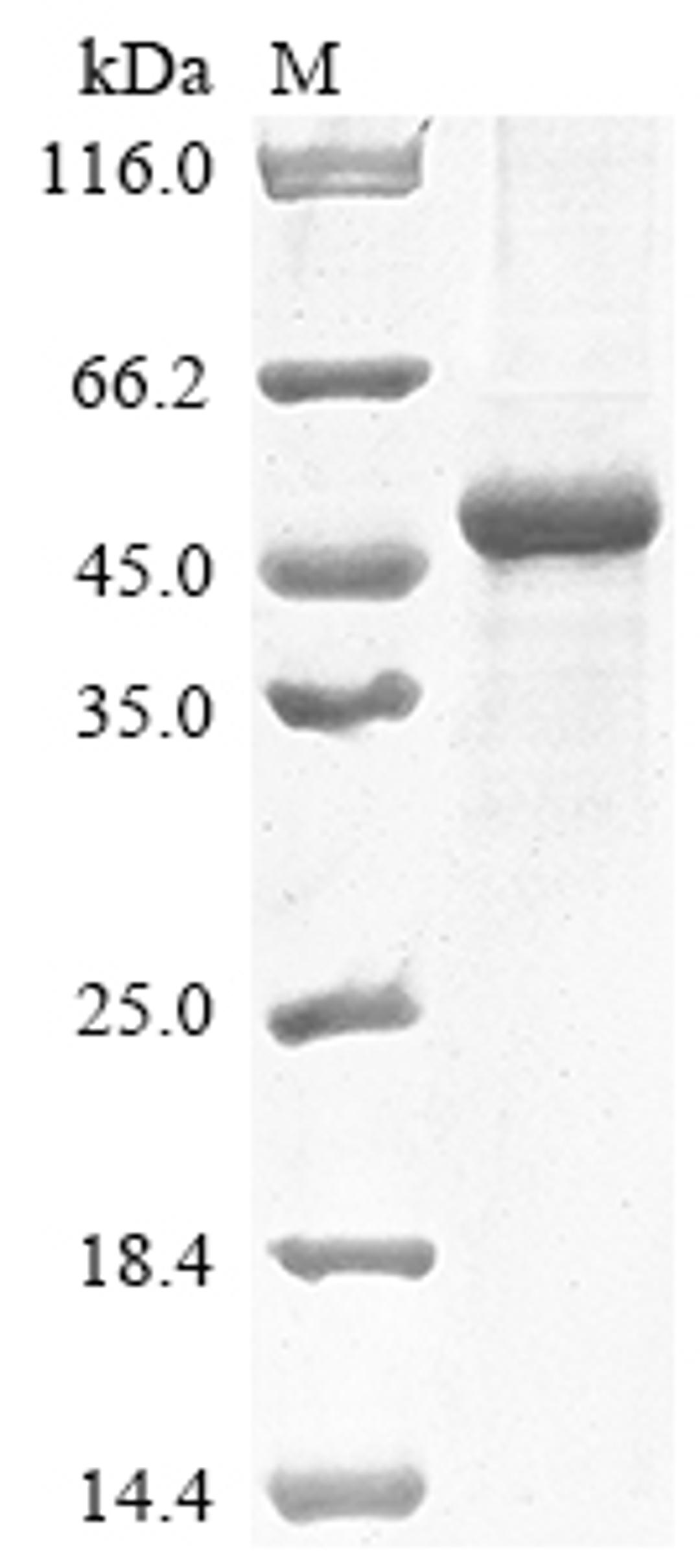 (Tris-Glycine gel) Discontinuous SDS-PAGE (reduced) with 5% enrichment gel and 15% separation gel.