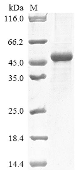 (Tris-Glycine gel) Discontinuous SDS-PAGE (reduced) with 5% enrichment gel and 15% separation gel.