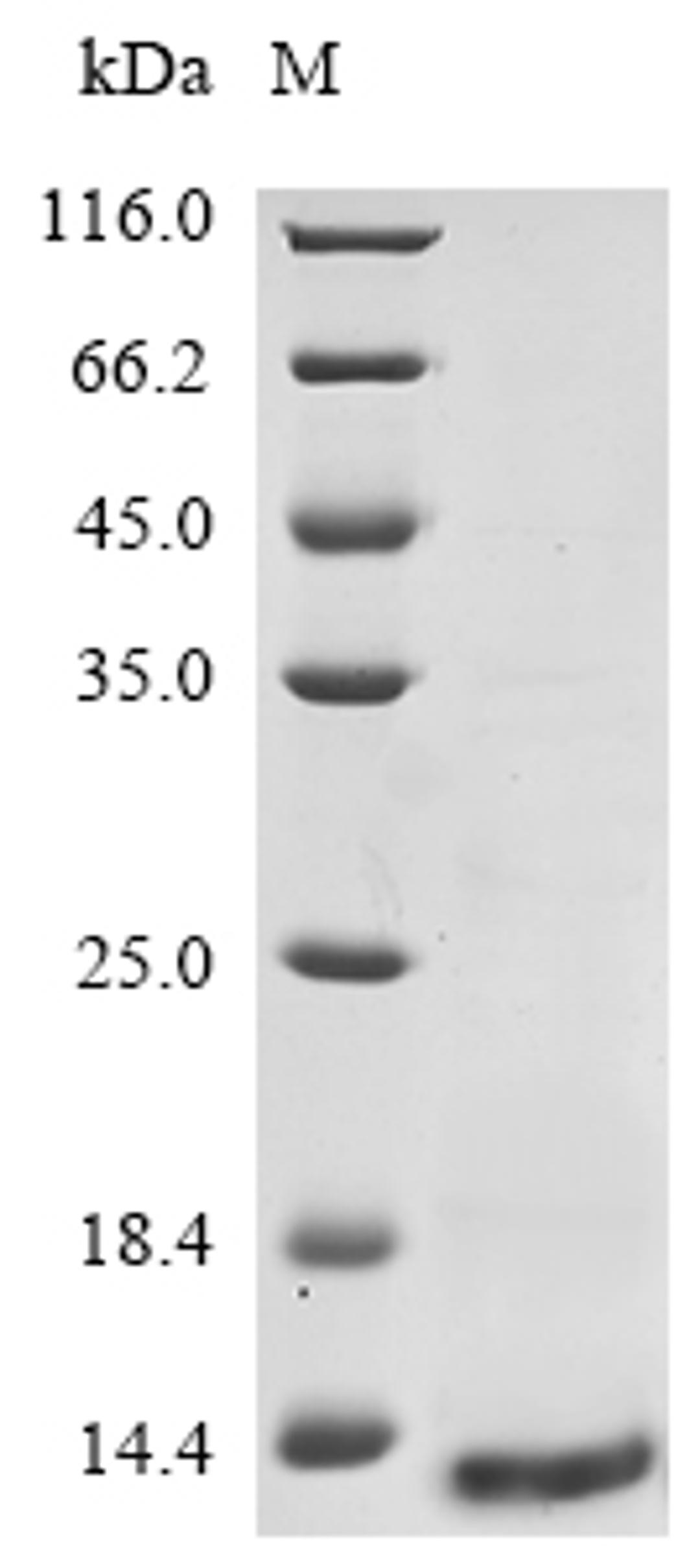 (Tris-Glycine gel) Discontinuous SDS-PAGE (reduced) with 5% enrichment gel and 15% separation gel.