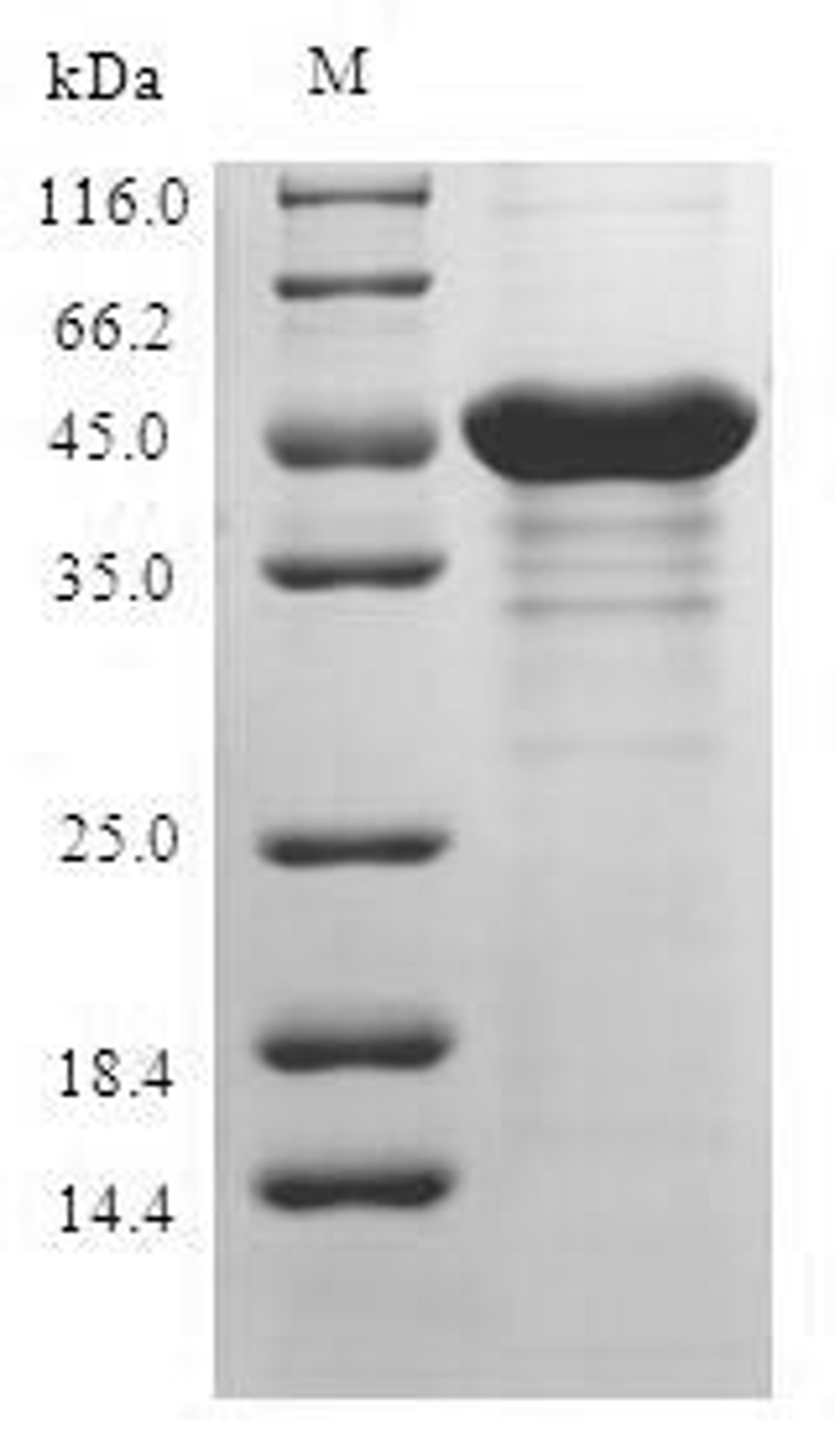 (Tris-Glycine gel) Discontinuous SDS-PAGE (reduced) with 5% enrichment gel and 15% separation gel.