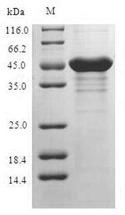 (Tris-Glycine gel) Discontinuous SDS-PAGE (reduced) with 5% enrichment gel and 15% separation gel.