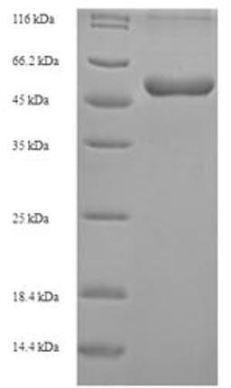 (Tris-Glycine gel) Discontinuous SDS-PAGE (reduced) with 5% enrichment gel and 15% separation gel.