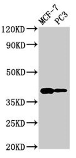 Western Blot. Positive WB detected in: MCF-7 whole cell lysate, PC-3 whole cell lysate. All lanes: DNASE2 antibody at 2.7ug/ml. Secondary. Goat polyclonal to rabbit IgG at 1/50000 dilution. Predicted band size: 40, 34 kDa. Observed band size: 40 kDa. 