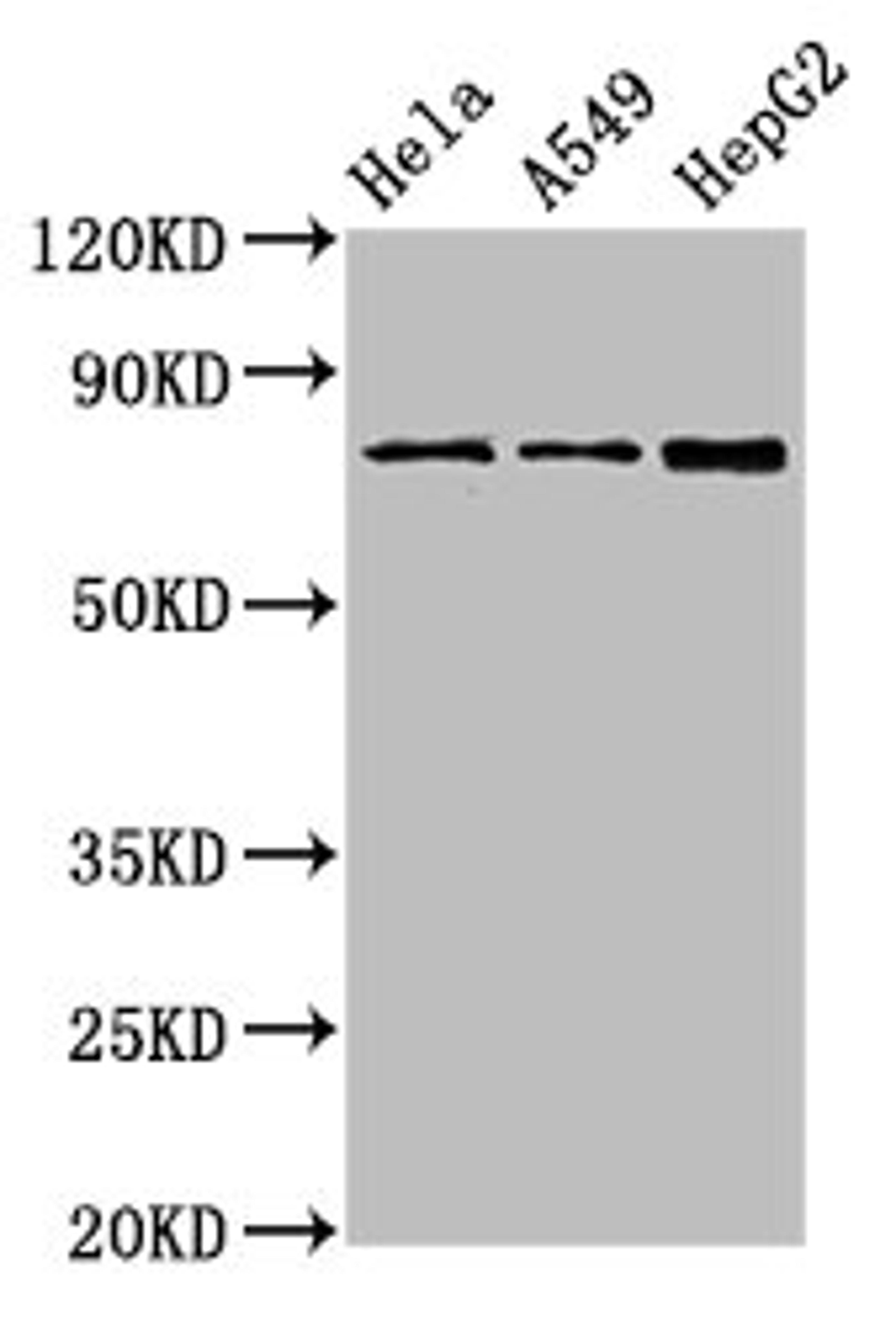 Western Blot. Positive WB detected in: Hela whole cell lysate, A549 whole cell lysate, HepG2 whole cell lysate. All lanes: TGM2 antibody at 4µg/ml. Secondary. Goat polyclonal to rabbit IgG at 1/50000 dilution. Predicted band size: 78, 62, 39 kDa. Observed band size: 78 kDa