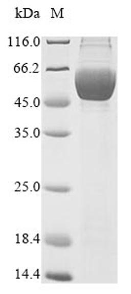 (Tris-Glycine gel) Discontinuous SDS-PAGE (reduced) with 5% enrichment gel and 15% separation gel.