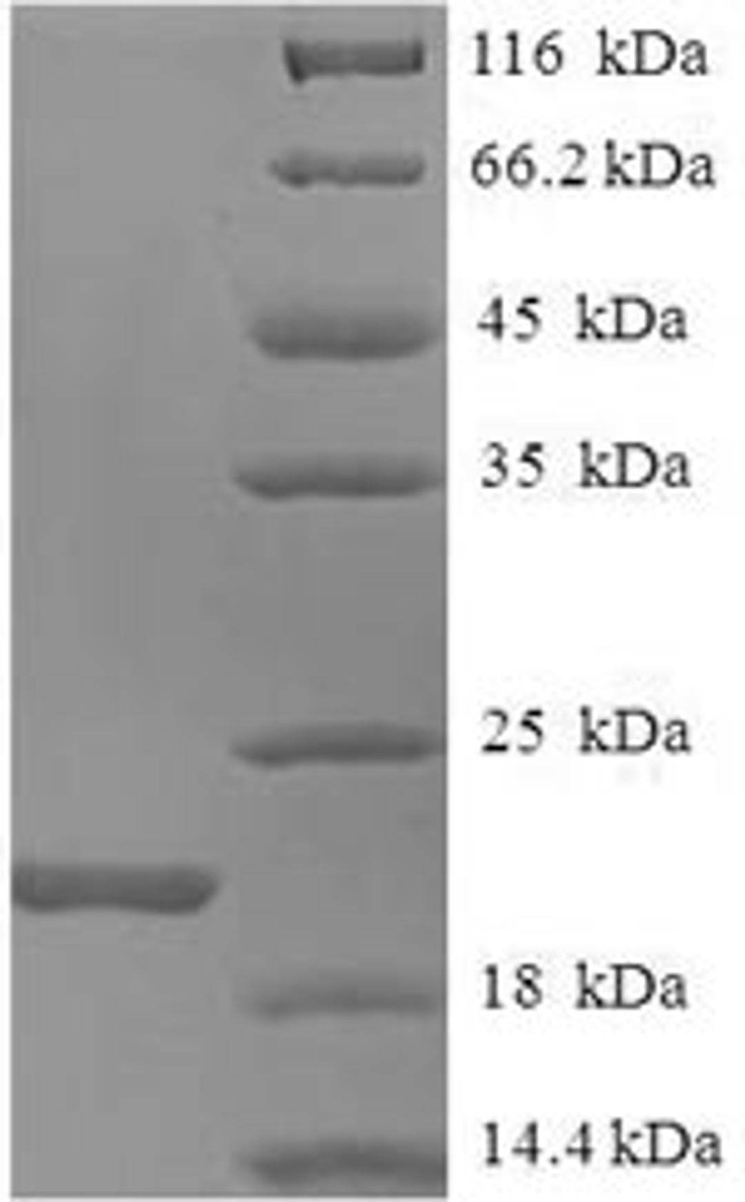 (Tris-Glycine gel) Discontinuous SDS-PAGE (reduced) with 5% enrichment gel and 15% separation gel.