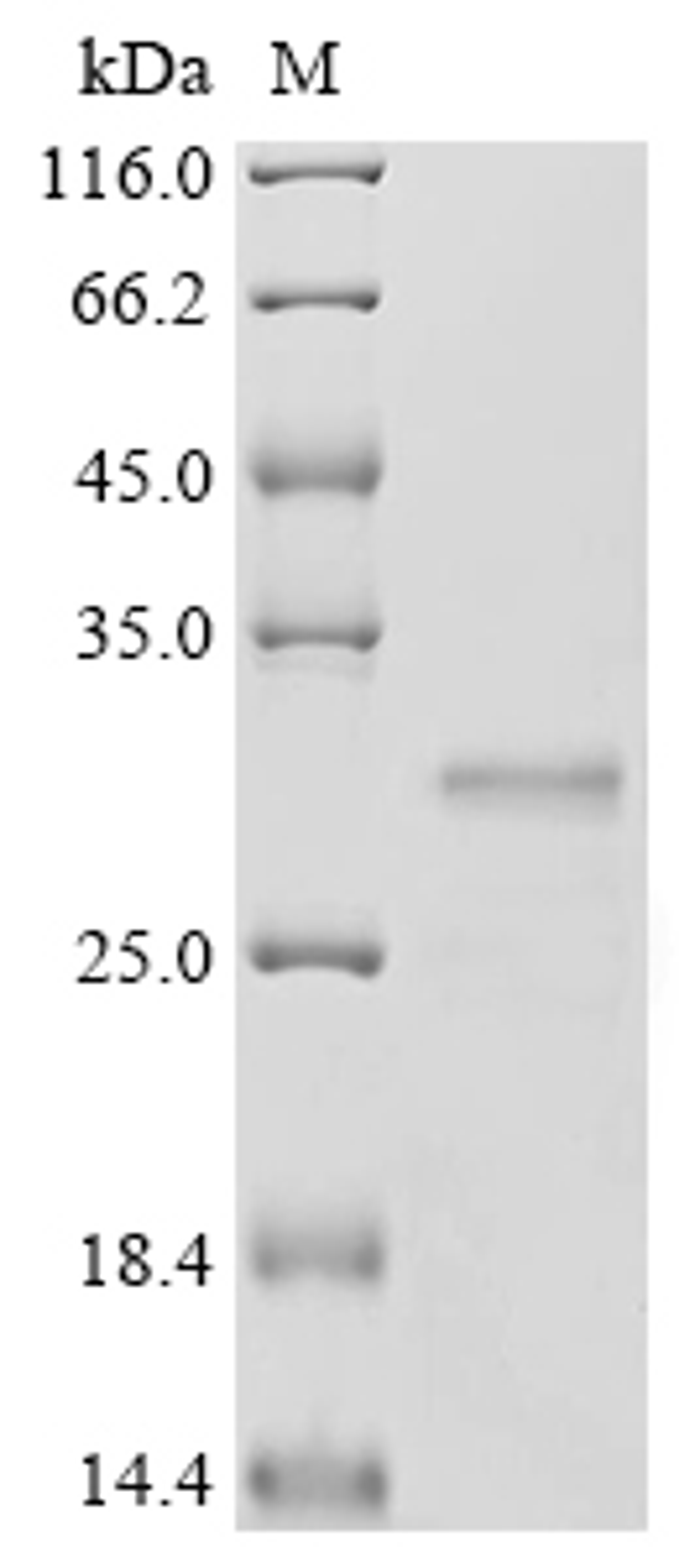 (Tris-Glycine gel) Discontinuous SDS-PAGE (reduced) with 5% enrichment gel and 15% separation gel.