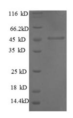 (Tris-Glycine gel) Discontinuous SDS-PAGE (reduced) with 5% enrichment gel and 15% separation gel.