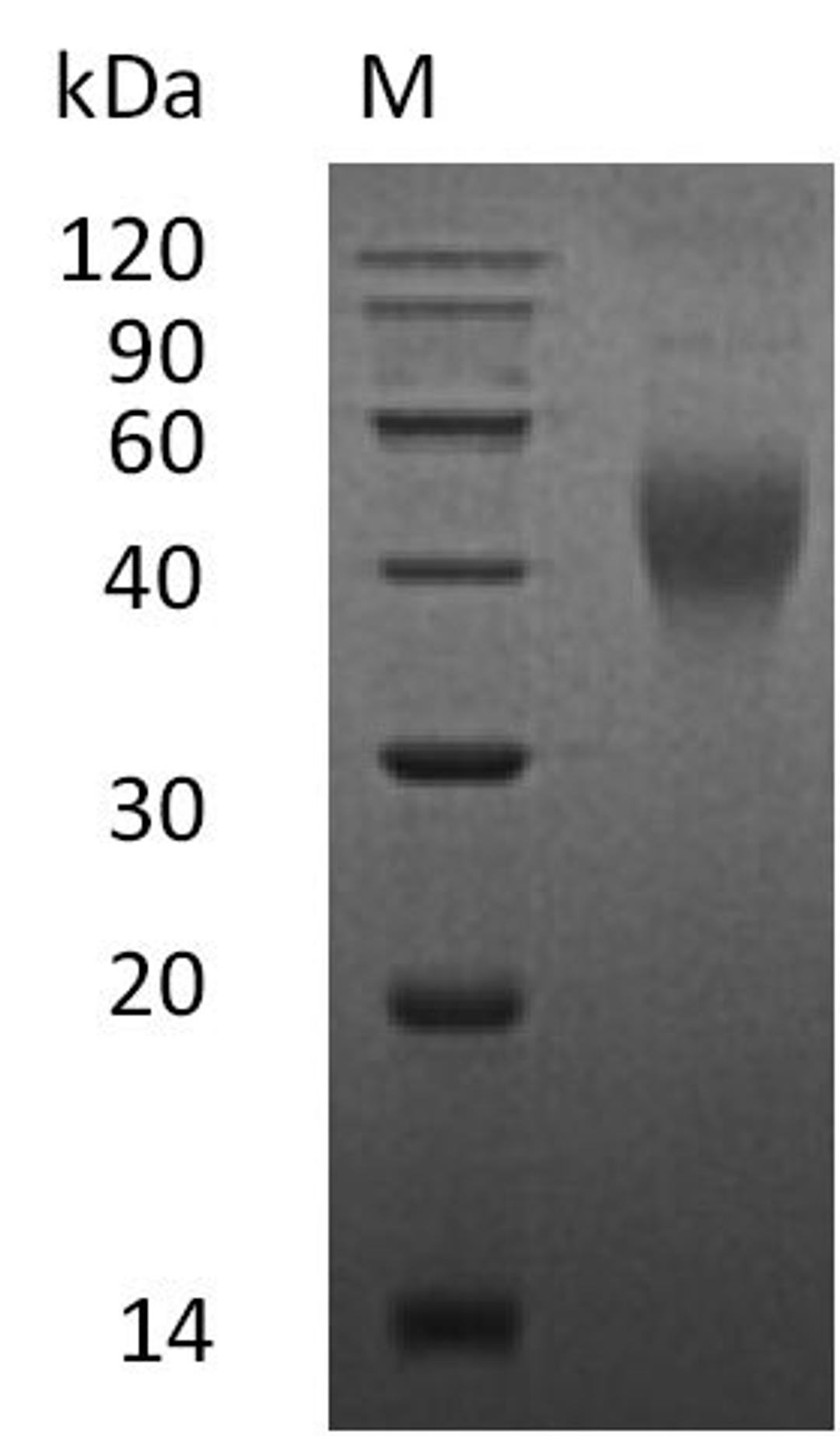 (Tris-Glycine gel) Discontinuous SDS-PAGE (reduced) with 5% enrichment gel and 15% separation gel.