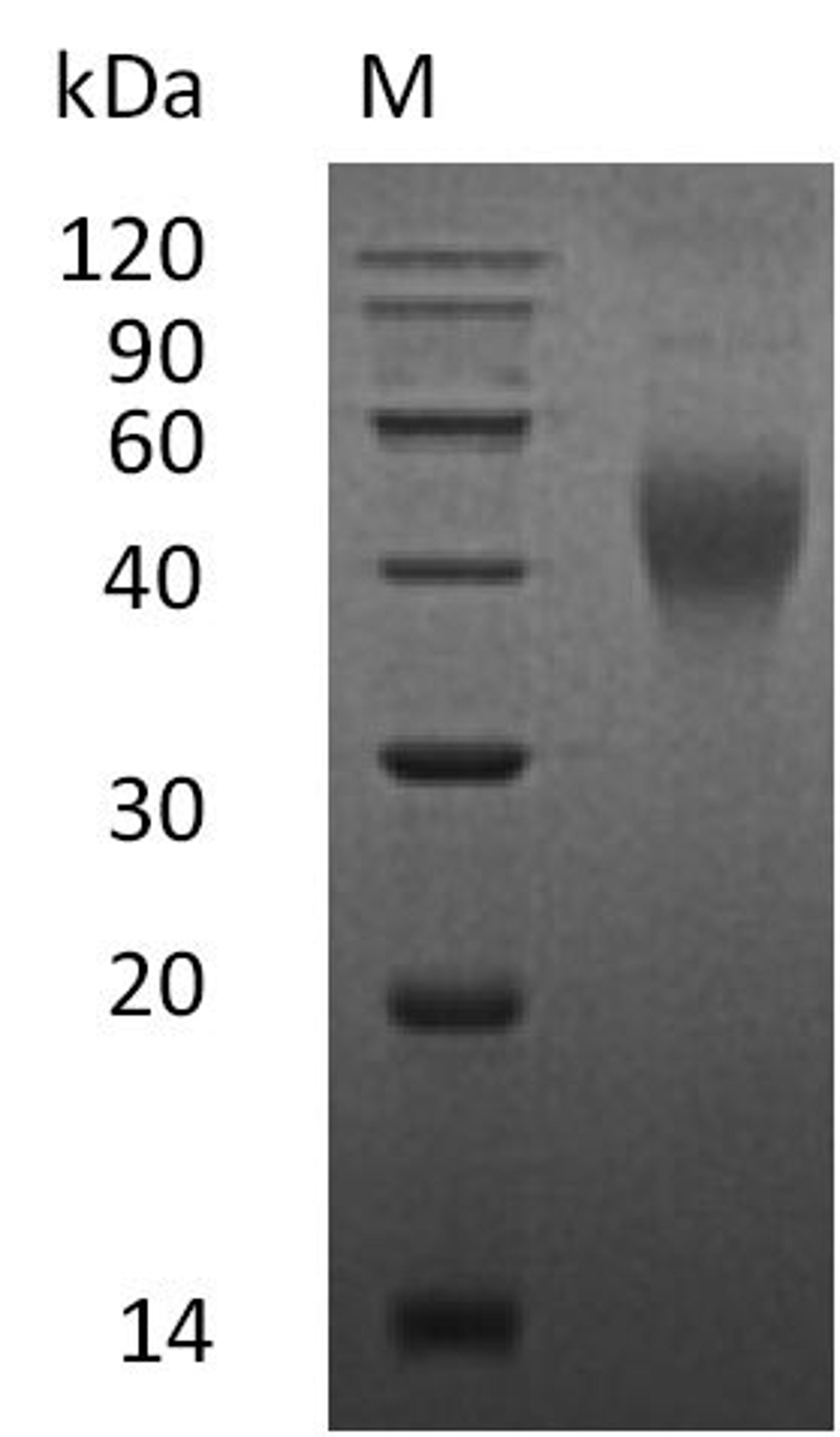 (Tris-Glycine gel) Discontinuous SDS-PAGE (reduced) with 5% enrichment gel and 15% separation gel.