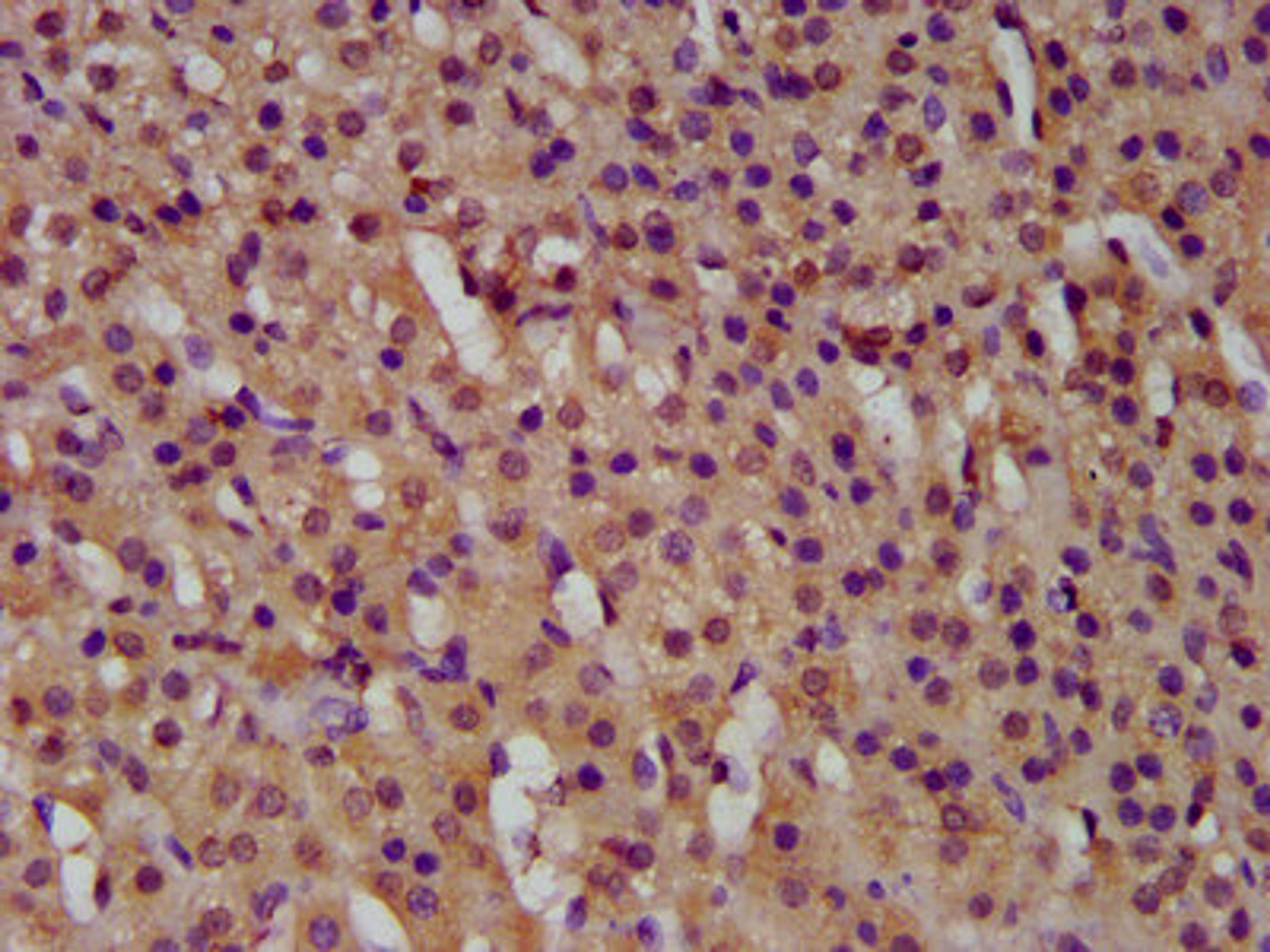 IHC image of CSB-PA010031LA01HU diluted at 1:500 and staining in paraffin-embedded human adrenal gland tissue performed on a Leica BondTM system. After dewaxing and hydration, antigen retrieval was mediated by high pressure in a citrate buffer (pH 6.0). Section was blocked with 10% normal goat serum 30min at RT. Then primary antibody (1% BSA) was incubated at 4&deg;C overnight. The primary is detected by a biotinylated secondary antibody and visualized using an HRP conjugated SP system.