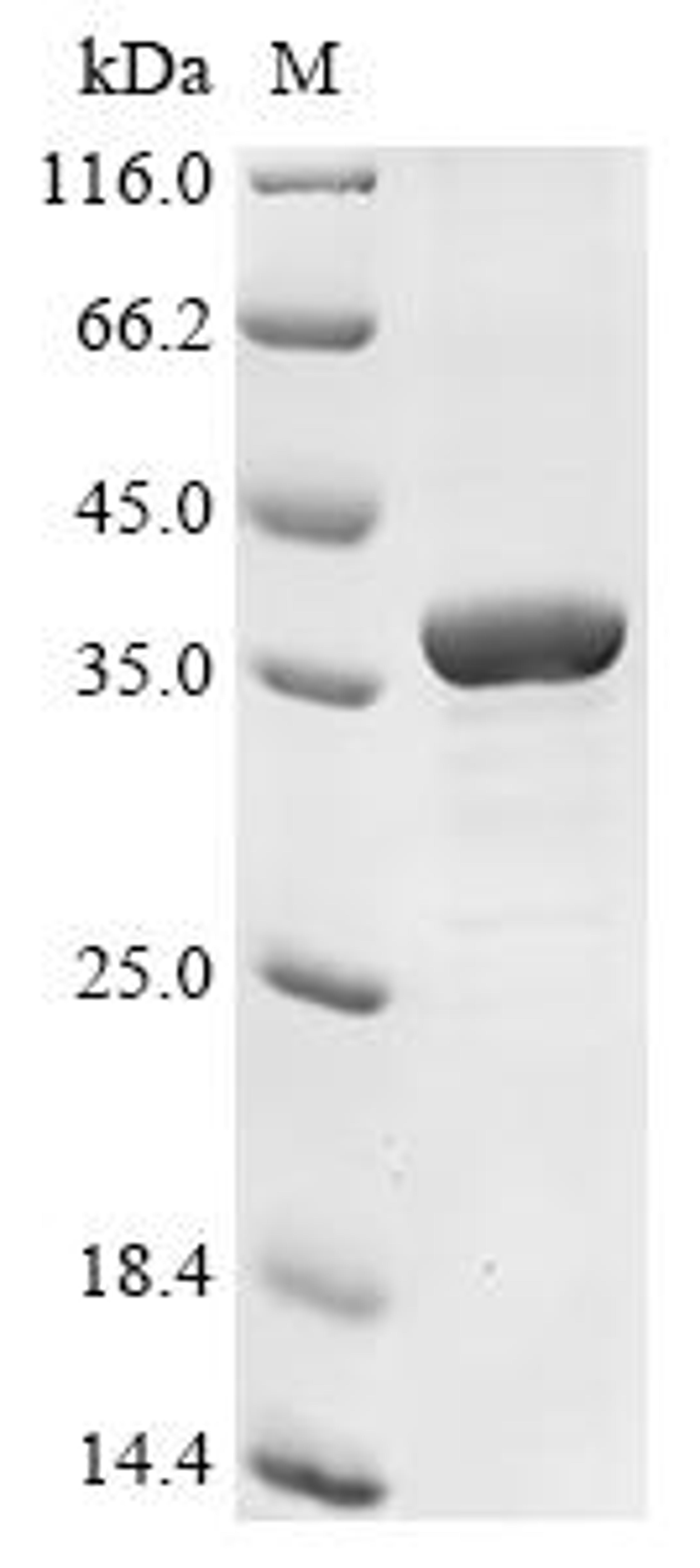 (Tris-Glycine gel) Discontinuous SDS-PAGE (reduced) with 5% enrichment gel and 15% separation gel.