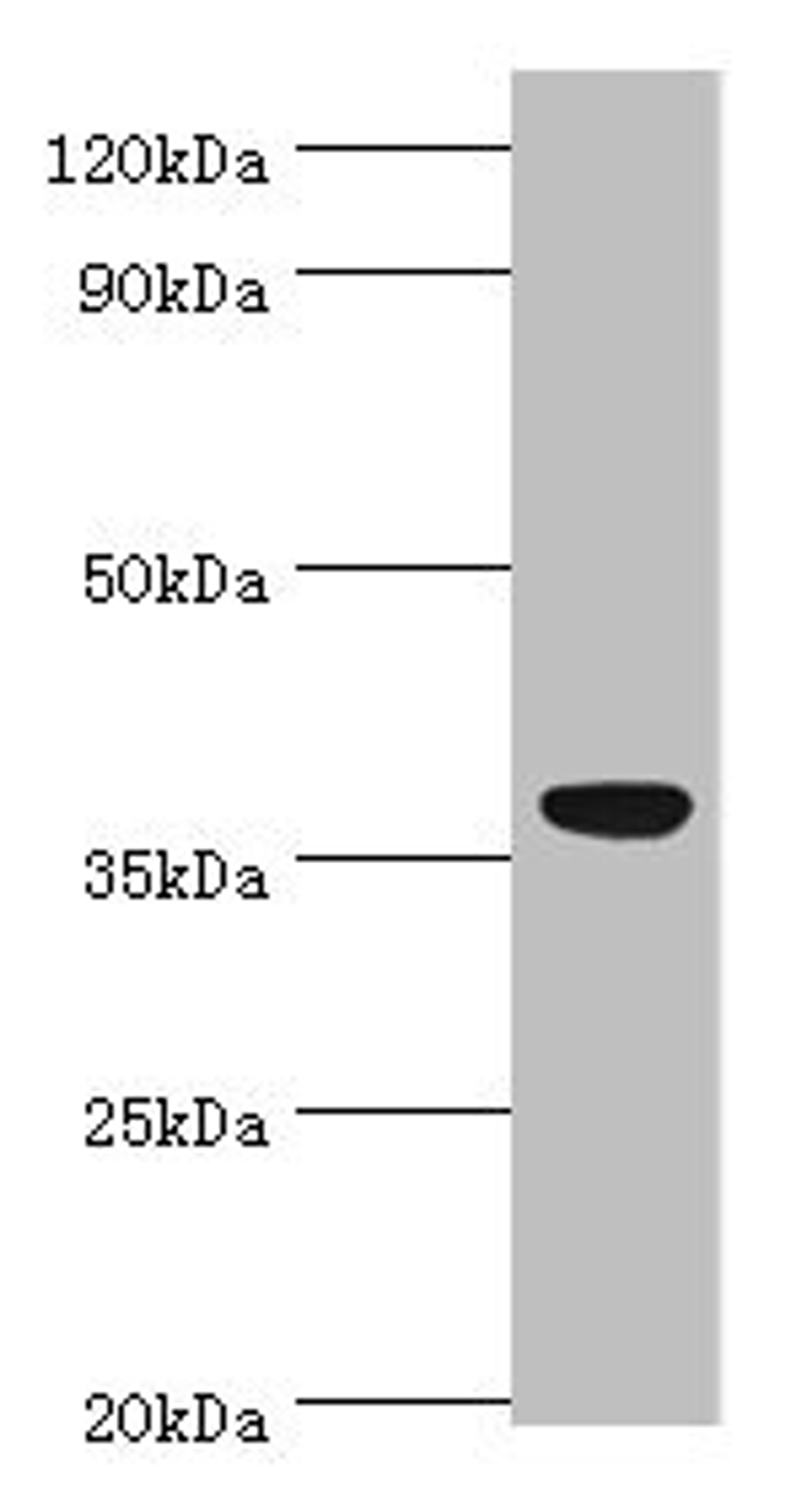 Western blot. All lanes: CD5L antibody at 3ug/ml + A431 whole cell lysate. Secondary. Goat polyclonal to rabbit IgG at 1/10000 dilution. Predicted band size: 38 kDa. Observed band size: 38 kDa. 