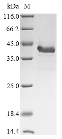 (Tris-Glycine gel) Discontinuous SDS-PAGE (reduced) with 5% enrichment gel and 15% separation gel.
