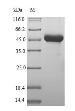 (Tris-Glycine gel) Discontinuous SDS-PAGE (reduced) with 5% enrichment gel and 15% separation gel.
