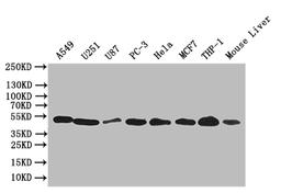 Western blot. All lanes: CRBN antibody at 4.65µg/ml. Lane 1: Mouse liver tissue. Lane 2: Colo320 whole cell lysate. Lane 3: A375 whole cell lysate. Secondary. Goat polyclonal to rabbit IgG at 1/10000 dilution. Predicted band size: 51 kDa. Observed band size: 51 kDa