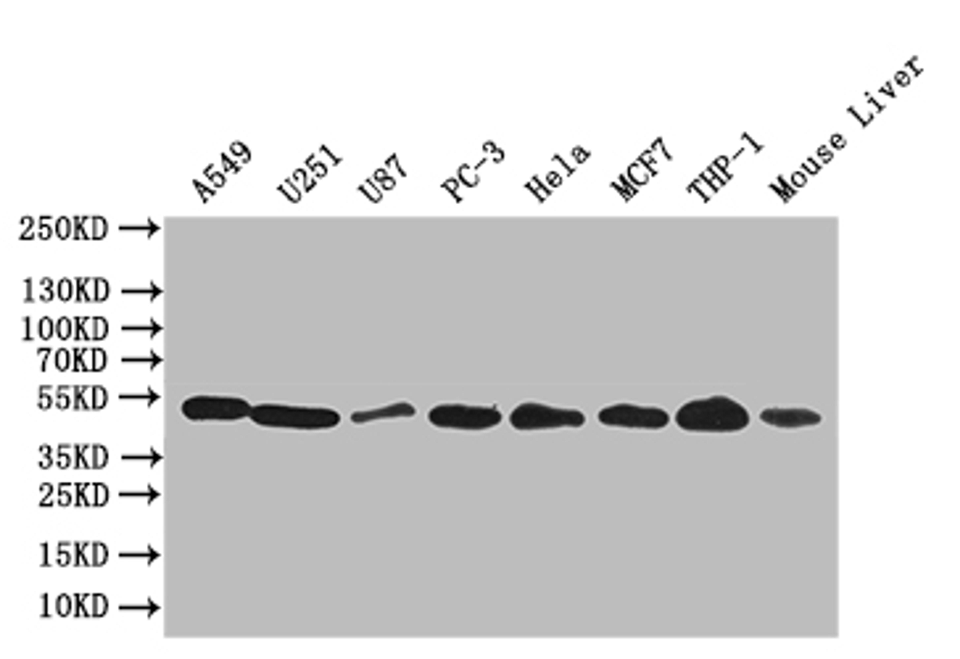 Western blot. All lanes: CRBN antibody at 4.65µg/ml. Lane 1: Mouse liver tissue. Lane 2: Colo320 whole cell lysate. Lane 3: A375 whole cell lysate. Secondary. Goat polyclonal to rabbit IgG at 1/10000 dilution. Predicted band size: 51 kDa. Observed band size: 51 kDa