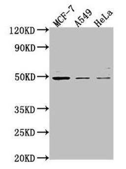 Western Blot. Positive WB detected in: MCF-7 whole cell lysate, A549 whole cell lysate, Hela whole cell lysate. All lanes: TSKU antibody at 1:2000. Secondary. Goat polyclonal to rabbit IgG at 1/50000 dilution. Predicted band size: 38 kDa. Observed band size: 49 kDa. 