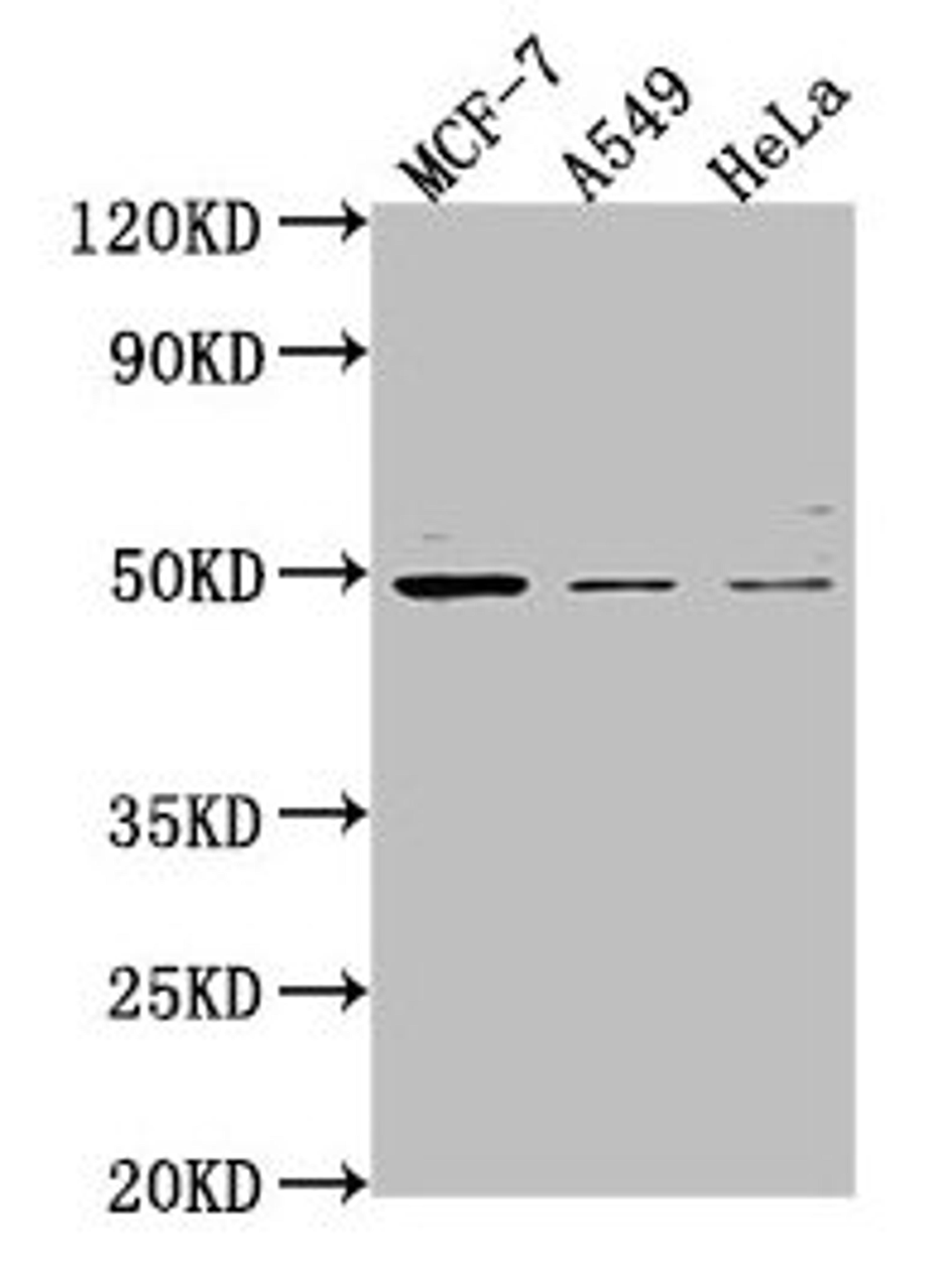 Western Blot. Positive WB detected in: MCF-7 whole cell lysate, A549 whole cell lysate, Hela whole cell lysate. All lanes: TSKU antibody at 1:2000. Secondary. Goat polyclonal to rabbit IgG at 1/50000 dilution. Predicted band size: 38 kDa. Observed band size: 49 kDa. 