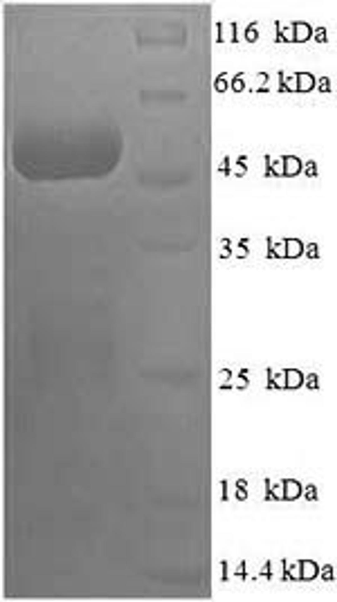 (Tris-Glycine gel) Discontinuous SDS-PAGE (reduced) with 5% enrichment gel and 15% separation gel.