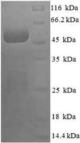 (Tris-Glycine gel) Discontinuous SDS-PAGE (reduced) with 5% enrichment gel and 15% separation gel.