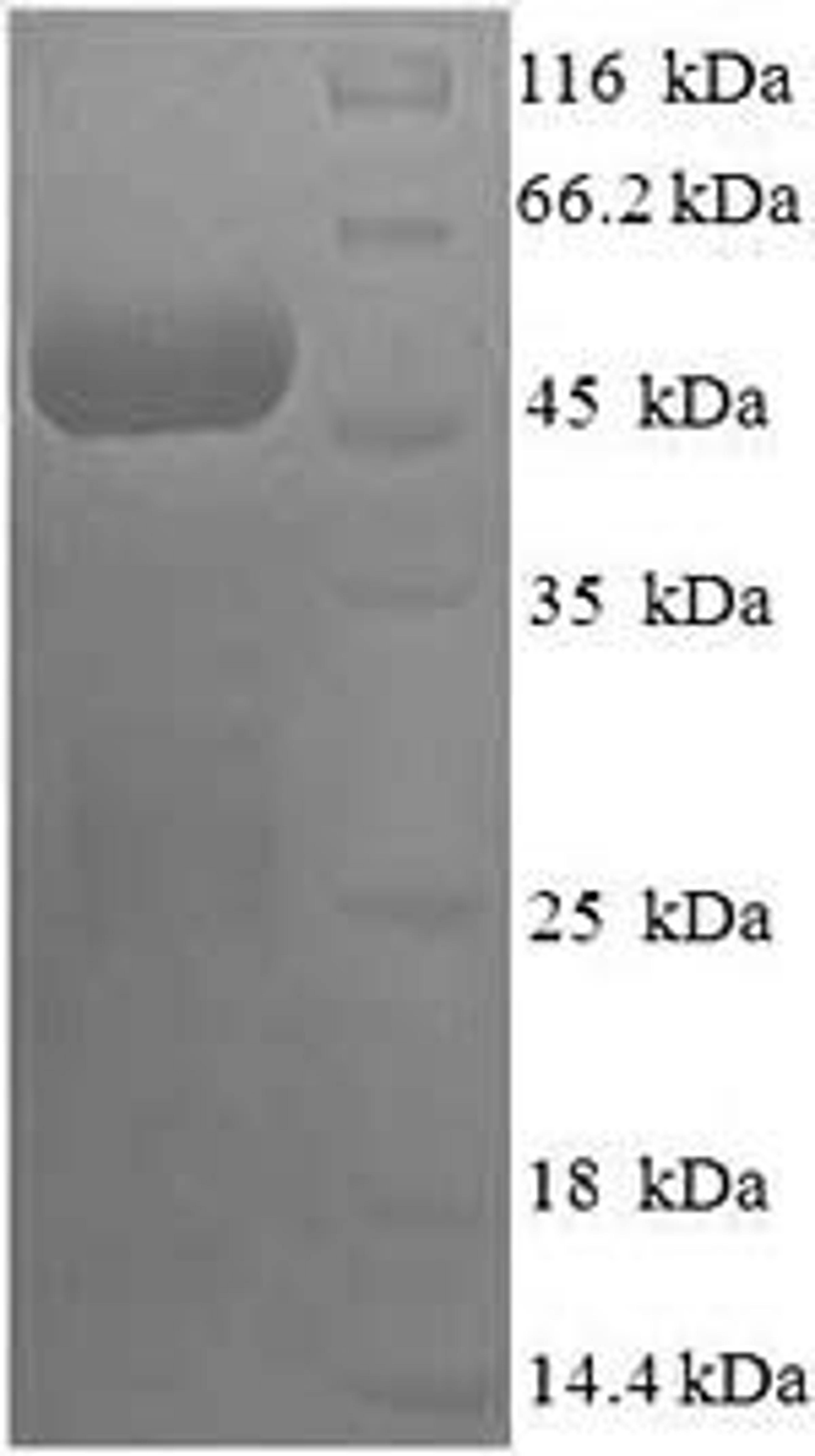 (Tris-Glycine gel) Discontinuous SDS-PAGE (reduced) with 5% enrichment gel and 15% separation gel.
