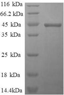 (Tris-Glycine gel) Discontinuous SDS-PAGE (reduced) with 5% enrichment gel and 15% separation gel.