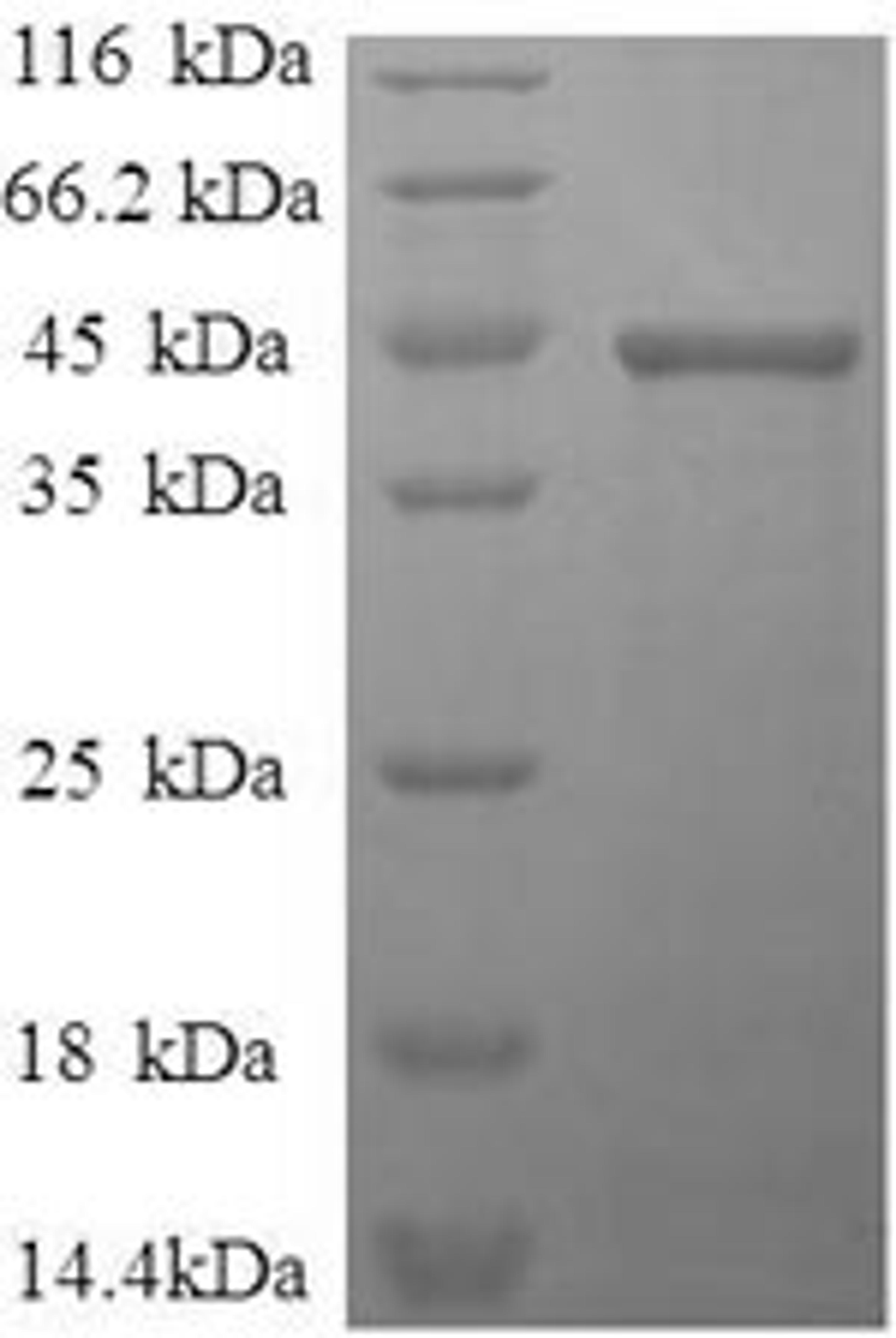 (Tris-Glycine gel) Discontinuous SDS-PAGE (reduced) with 5% enrichment gel and 15% separation gel.