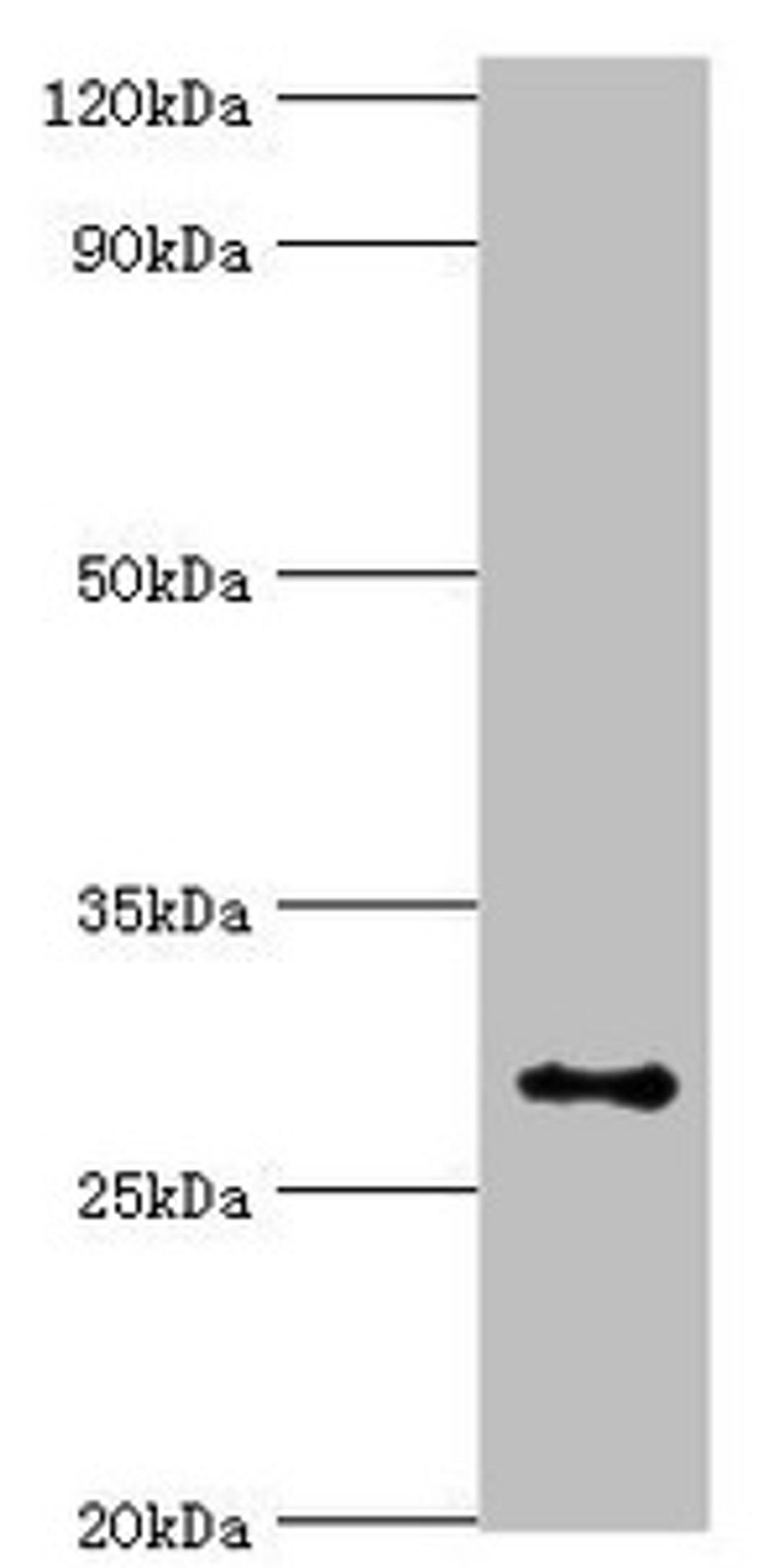 Western blot. All lanes: Alpha-ketoglutarate-dependent dioxygenase alkB homolog 2 antibody at 2ug/ml + Hela whole cell lysate. Secondary. Goat polyclonal to rabbit IgG at 1/10000 dilution. Predicted band size: 30, 18 kDa. Observed band size: 30 kDa. 