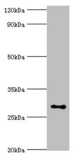 Western blot. All lanes: Alpha-ketoglutarate-dependent dioxygenase alkB homolog 2 antibody at 2ug/ml + Hela whole cell lysate. Secondary. Goat polyclonal to rabbit IgG at 1/10000 dilution. Predicted band size: 30, 18 kDa. Observed band size: 30 kDa. 
