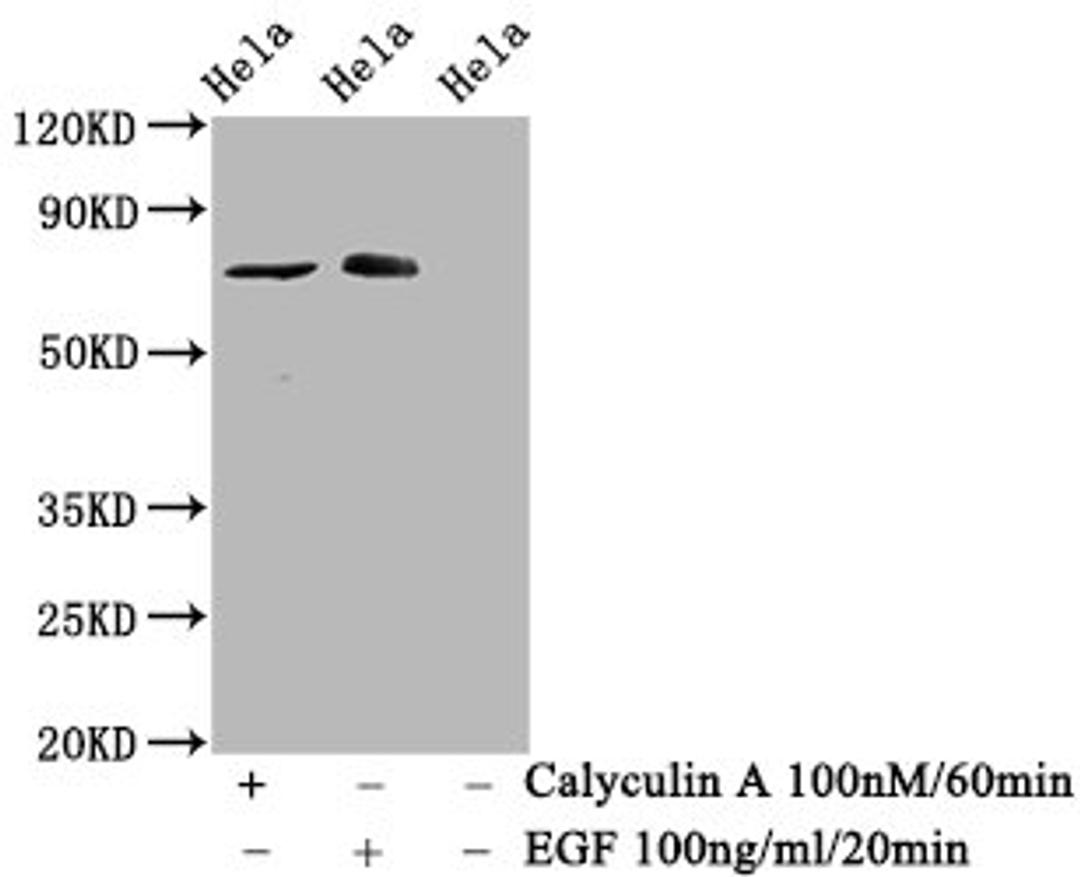 Western Blot. Positive WB detected in Hela whole cell lysate(treated with Calyculin A or EGF). All lanes Phospho-RAF1 antibody at 1.525μg/ml. Secondary. Goat polyclonal to rabbit IgG at 1/50000 dilution. Predicted band size: 73 KDa. Observed band size: 73 KDa. 