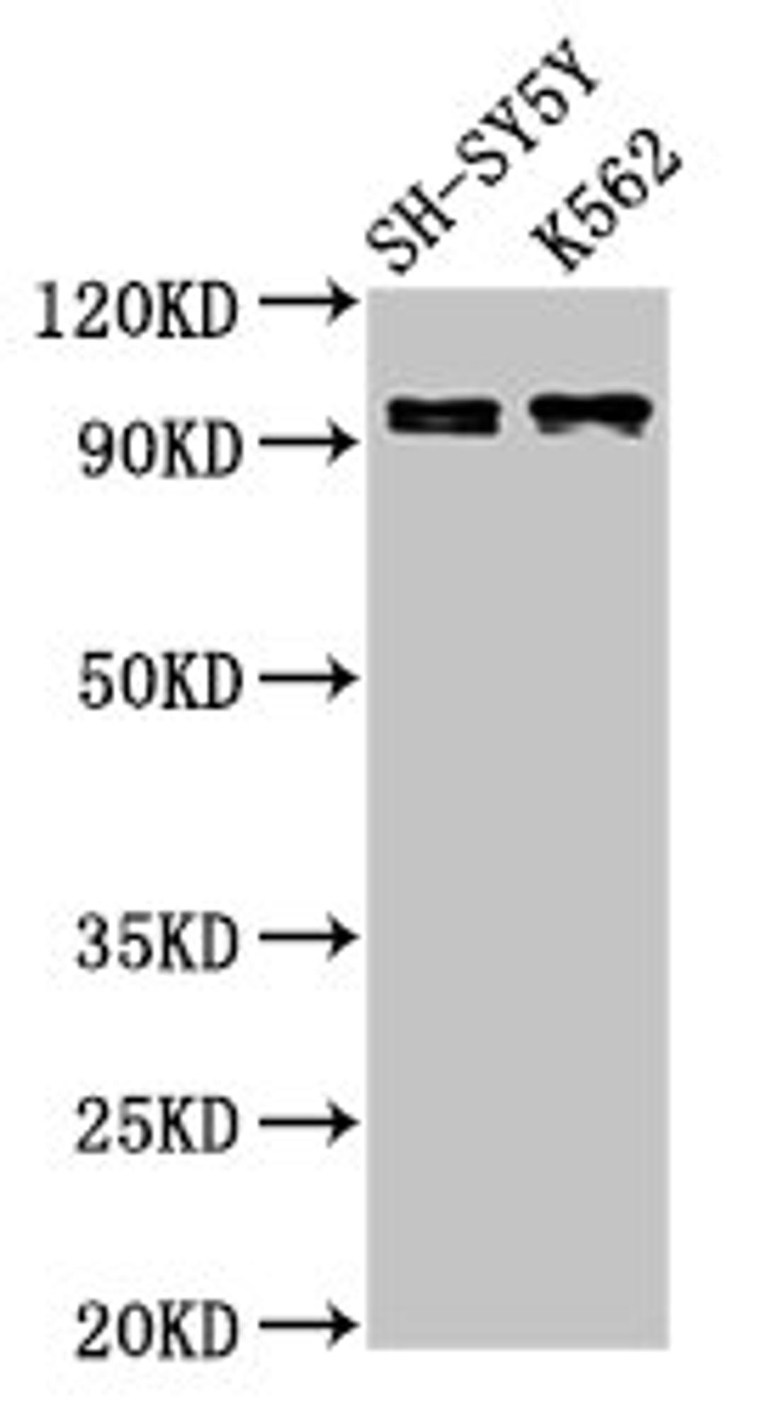 Western Blot. Positive WB detected in: SH-SY5Y whole cell lysate, K562 whole cell lysate. All lanes: KCNQ3 antibody at 3ug/ml. Secondary. Goat polyclonal to rabbit IgG at 1/50000 dilution. Predicted band size: 97, 85 kDa. Observed band size: 97 kDa. 