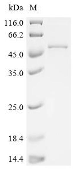 (Tris-Glycine gel) Discontinuous SDS-PAGE (reduced) with 5% enrichment gel and 15% separation gel.