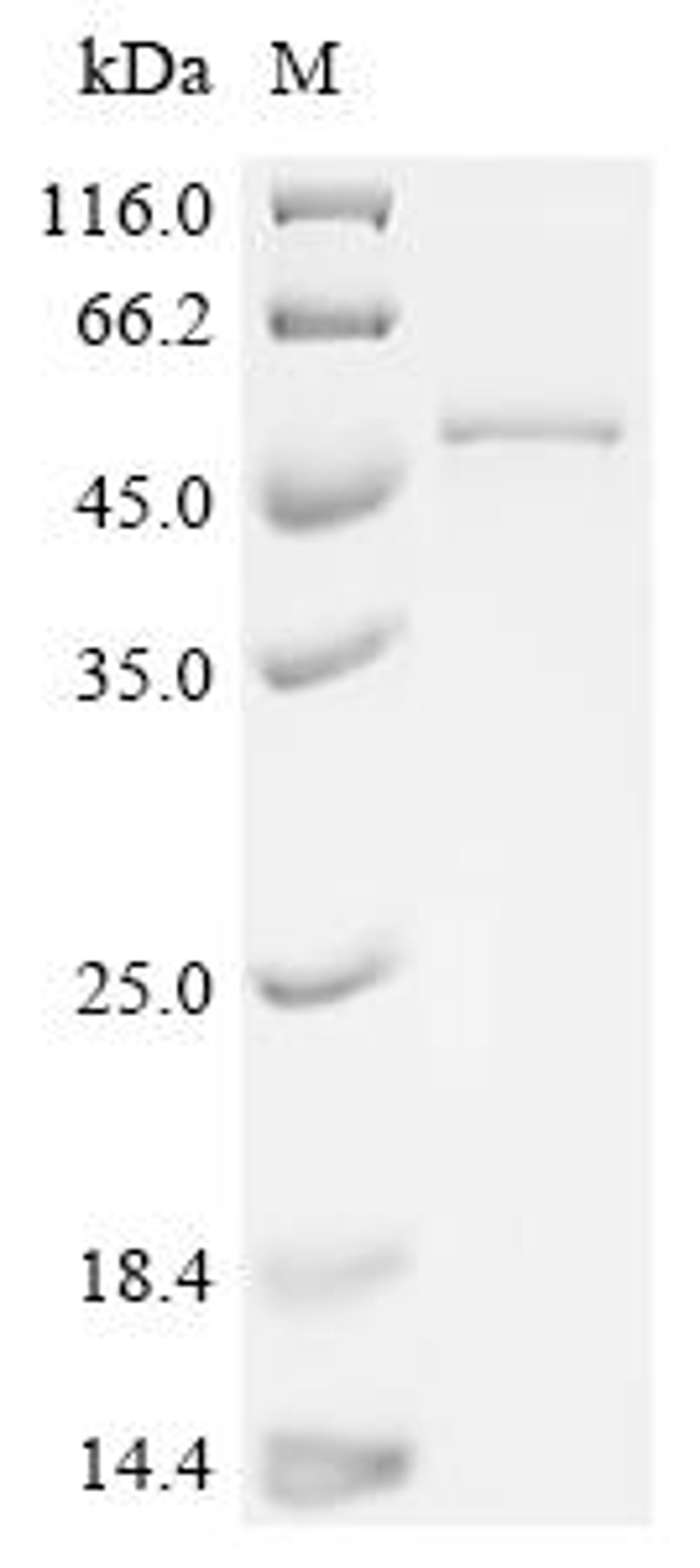 (Tris-Glycine gel) Discontinuous SDS-PAGE (reduced) with 5% enrichment gel and 15% separation gel.