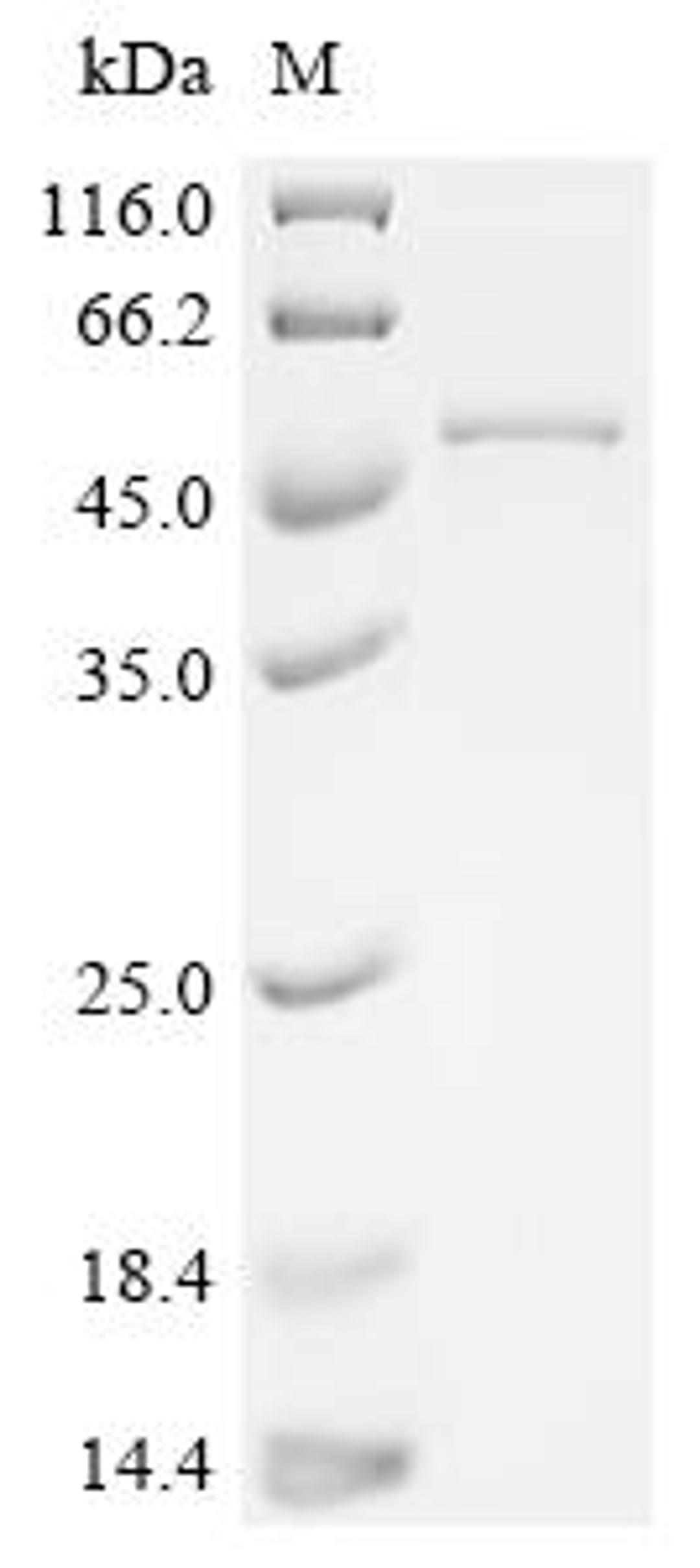 (Tris-Glycine gel) Discontinuous SDS-PAGE (reduced) with 5% enrichment gel and 15% separation gel.
