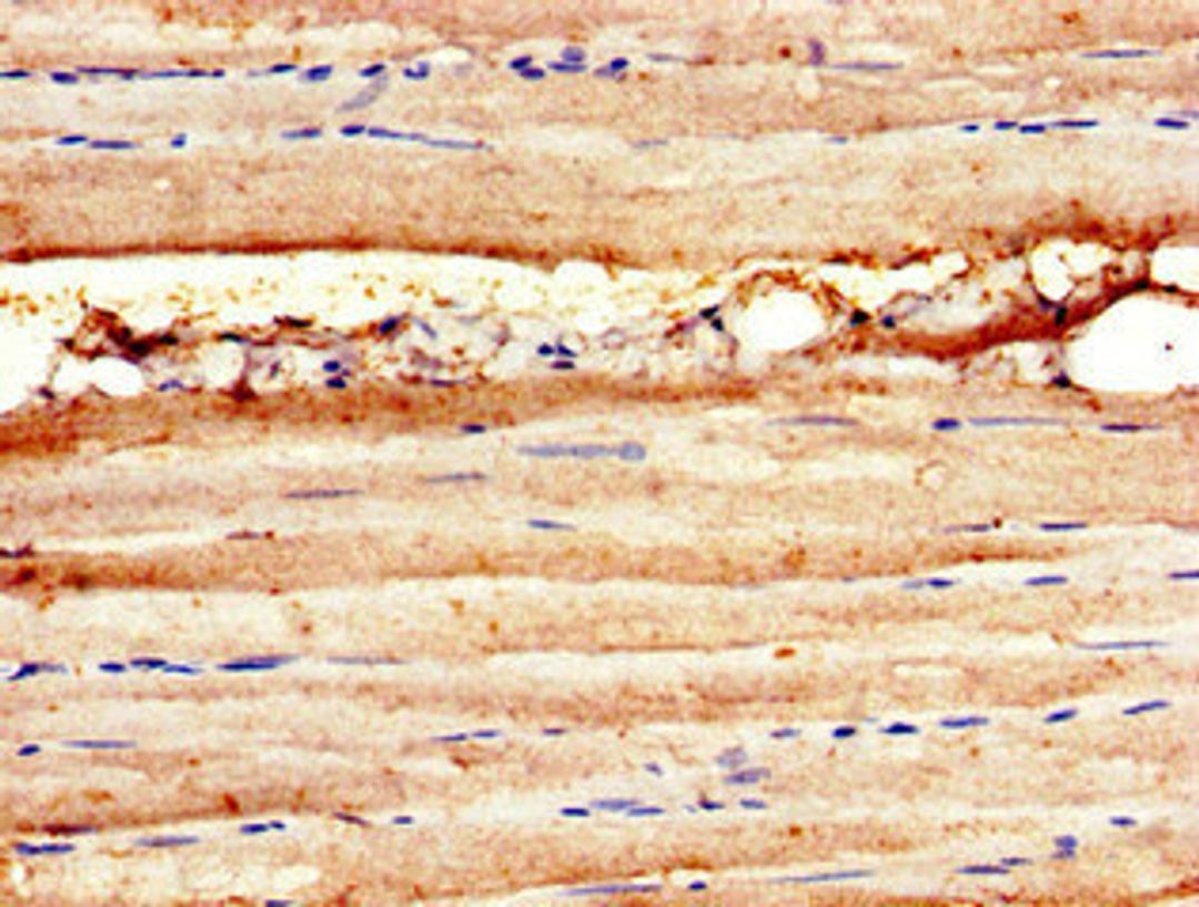 Immunohistochemistry of paraffin-embedded human skeletal muscle tissue using CSB-PA01469A0Rb at dilution of 1:100