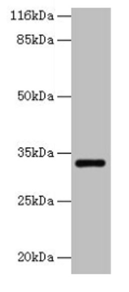 Western blot. All lanes: ERGIC1 antibody at 2µg/ml + HepG2 whole cell lysate. Secondary. Goat polyclonal to rabbit IgG at 1/10000 dilution. Predicted band size: 33, 23, 18 kDa. Observed band size: 33 kDa