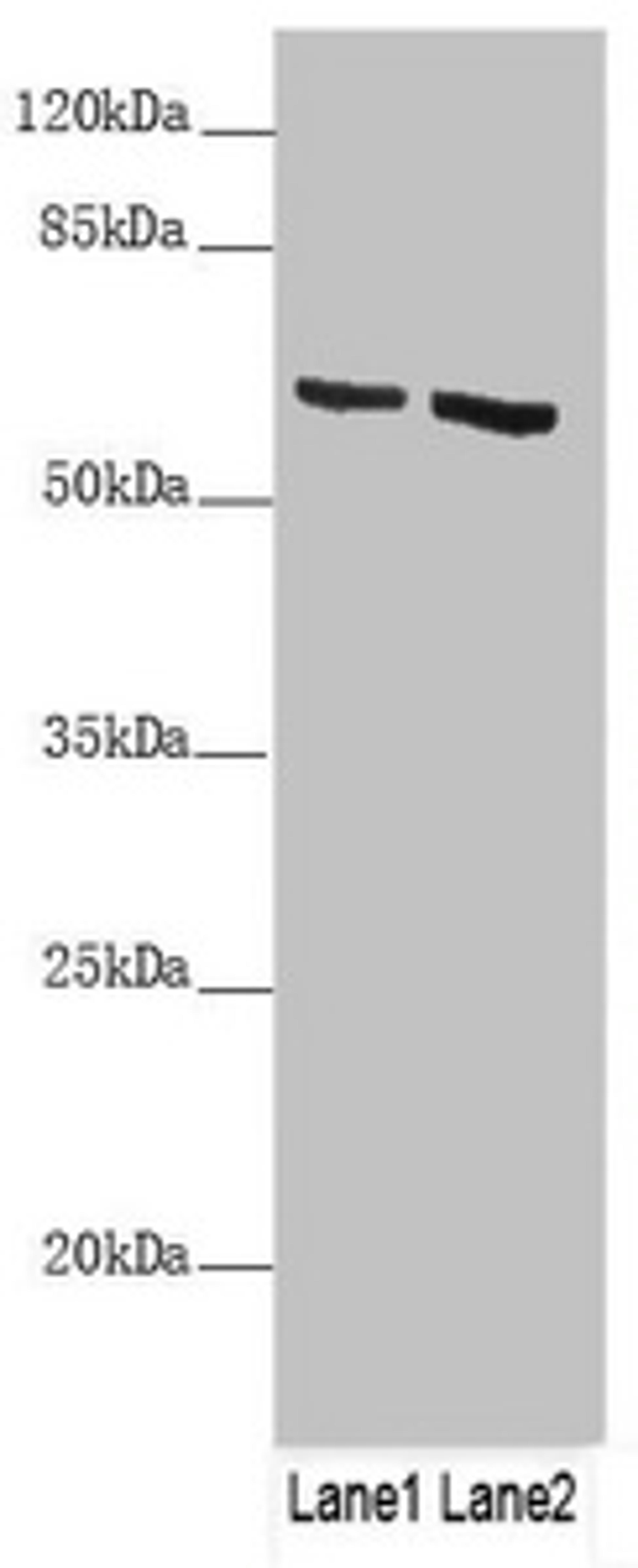 Western blot. All lanes: KRT6B antibody at 4.29 ug/ml. Lane 1: A431 whole cell lysate. Lane 2: A375 whole cell lysate. Secondary. Goat polyclonal to rabbit IgG at 1/10000 dilution. Predicted band size: 60 kDa. Observed band size: 60 kDa. 