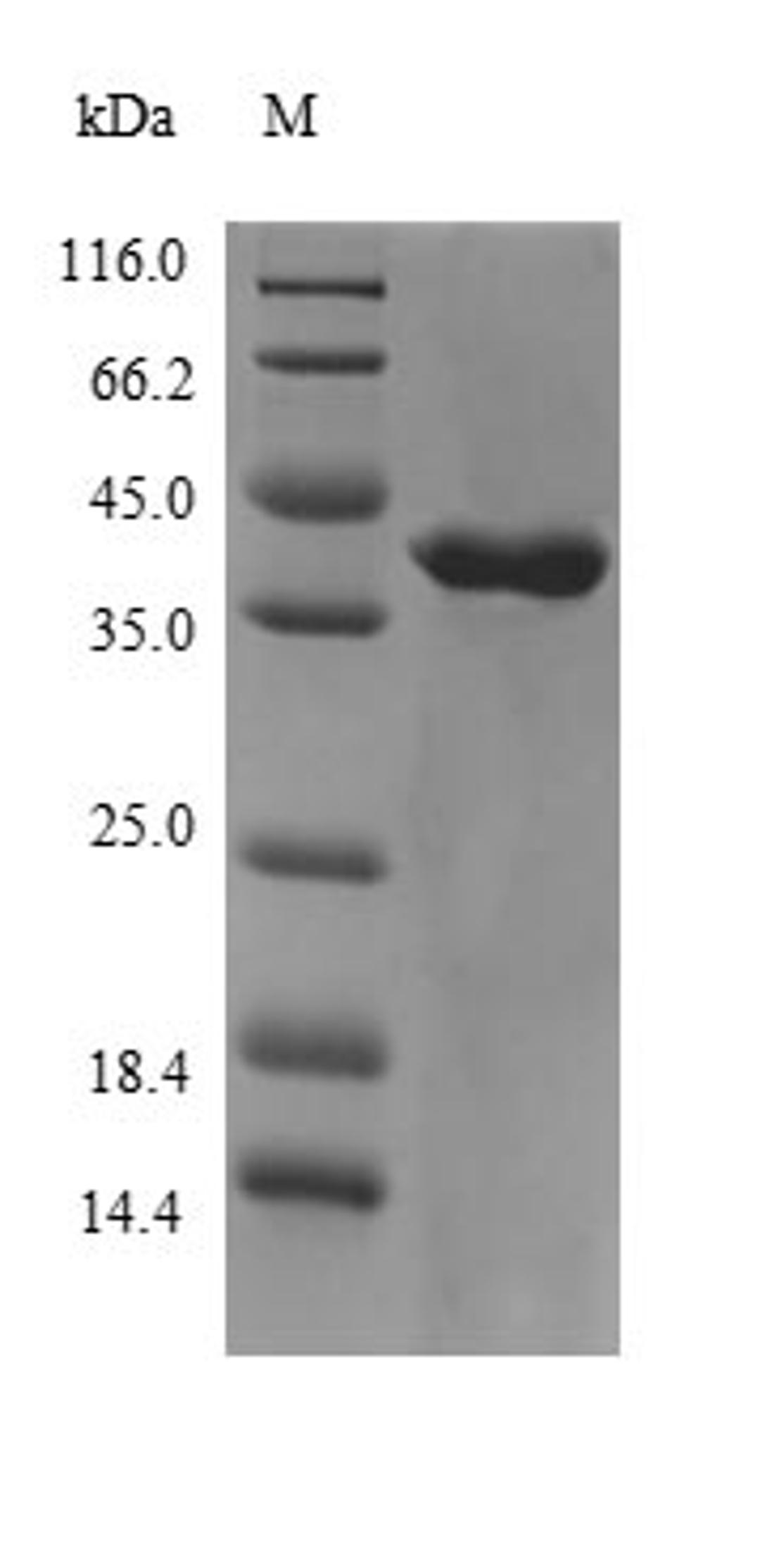 (Tris-Glycine gel) Discontinuous SDS-PAGE (reduced) with 5% enrichment gel and 15% separation gel.