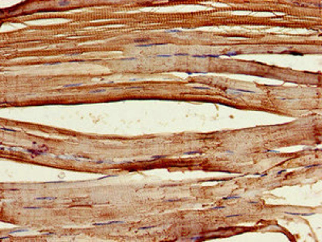 Immunohistochemistry of paraffin-embedded human skeletal muscle tissue using CSB-PA705514LA01HU at dilution of 1:100