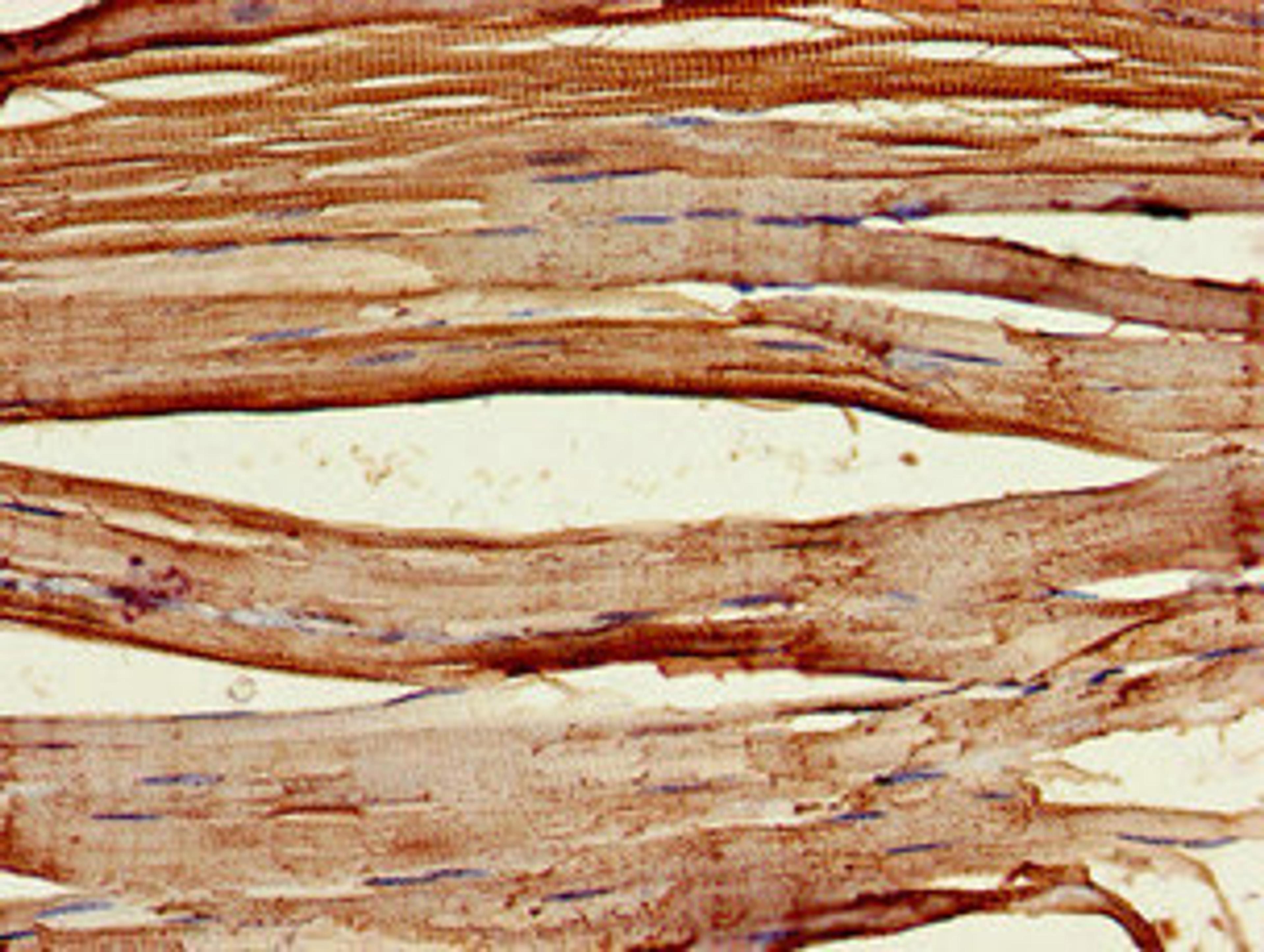 Immunohistochemistry of paraffin-embedded human skeletal muscle tissue using CSB-PA705514LA01HU at dilution of 1:100