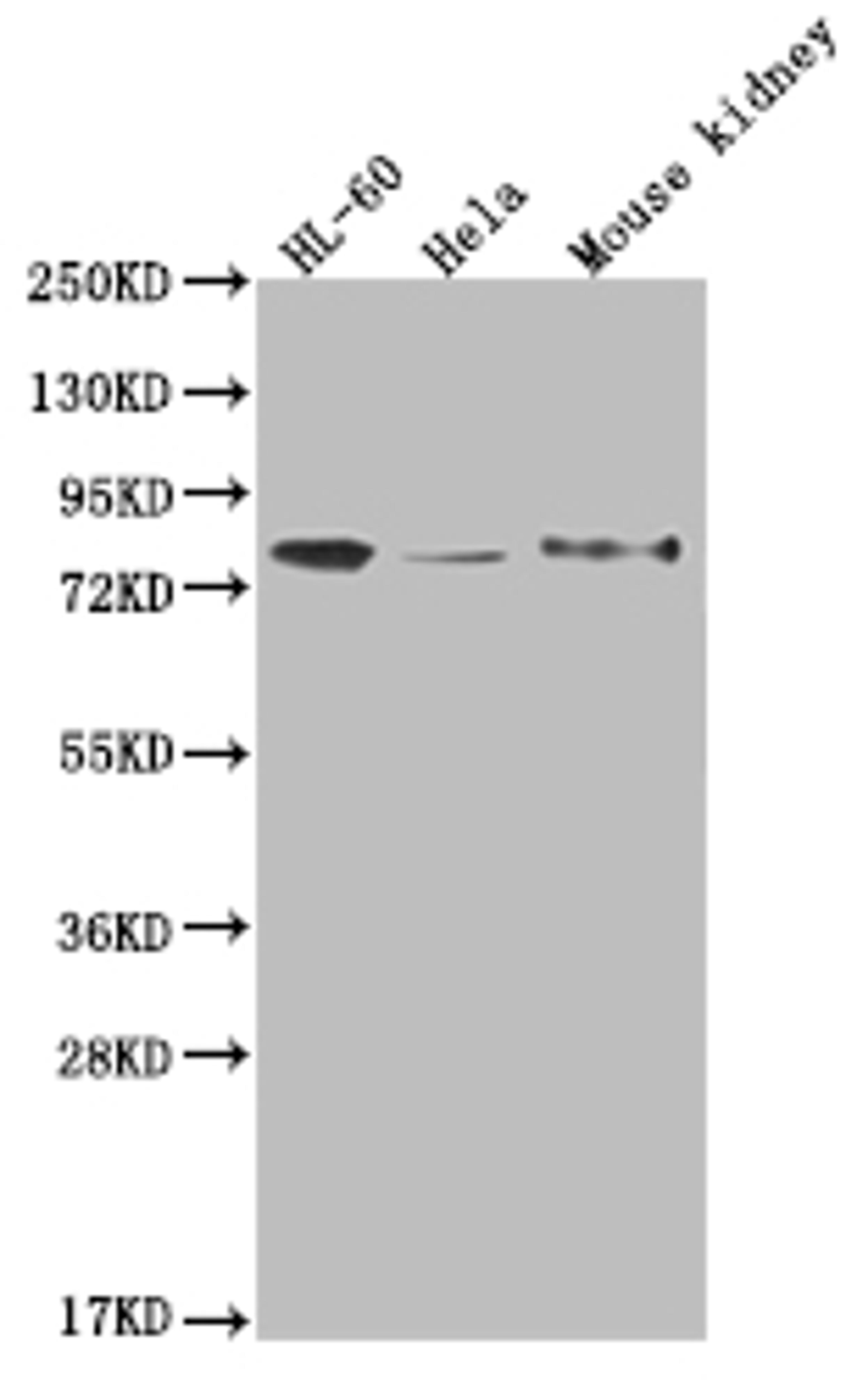 Western Blot. Positive WB detected in: HL-60 whole cell lysate, Hela whole cell lysate, Mouse kidney tissue. All lanes: OS9 antibody at 1:2000. Secondary. Goat polyclonal to rabbit IgG at 1/50000 dilution. Predicted band size: 76, 70, 68, 74, 66, 64, 70, 61 kDa. Observed band size: 72-95 kDa. 