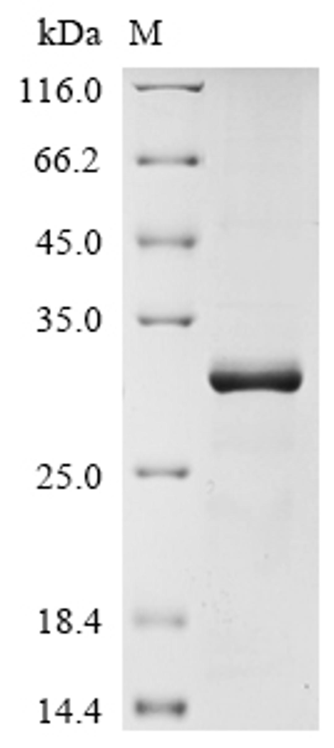 (Tris-Glycine gel) Discontinuous SDS-PAGE (reduced) with 5% enrichment gel and 15% separation gel.