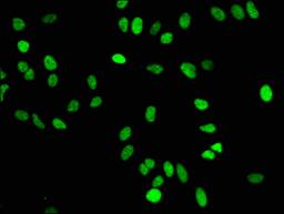 Immunofluorescence staining of Hela cells with CSB-RA010429A16me1HU at 1:50,counter-stained with DAPI. The cells were fixed in 4% formaldehyde, permeabilized using 0.2% Triton X-100 and blocked in 10% normal Goat Serum. The cells were then incubated with the antibody overnight at 4℃.The secondary antibody was Alexa Fluor 488-congugated AffiniPure Goat Anti-Rabbit IgG (H+L).