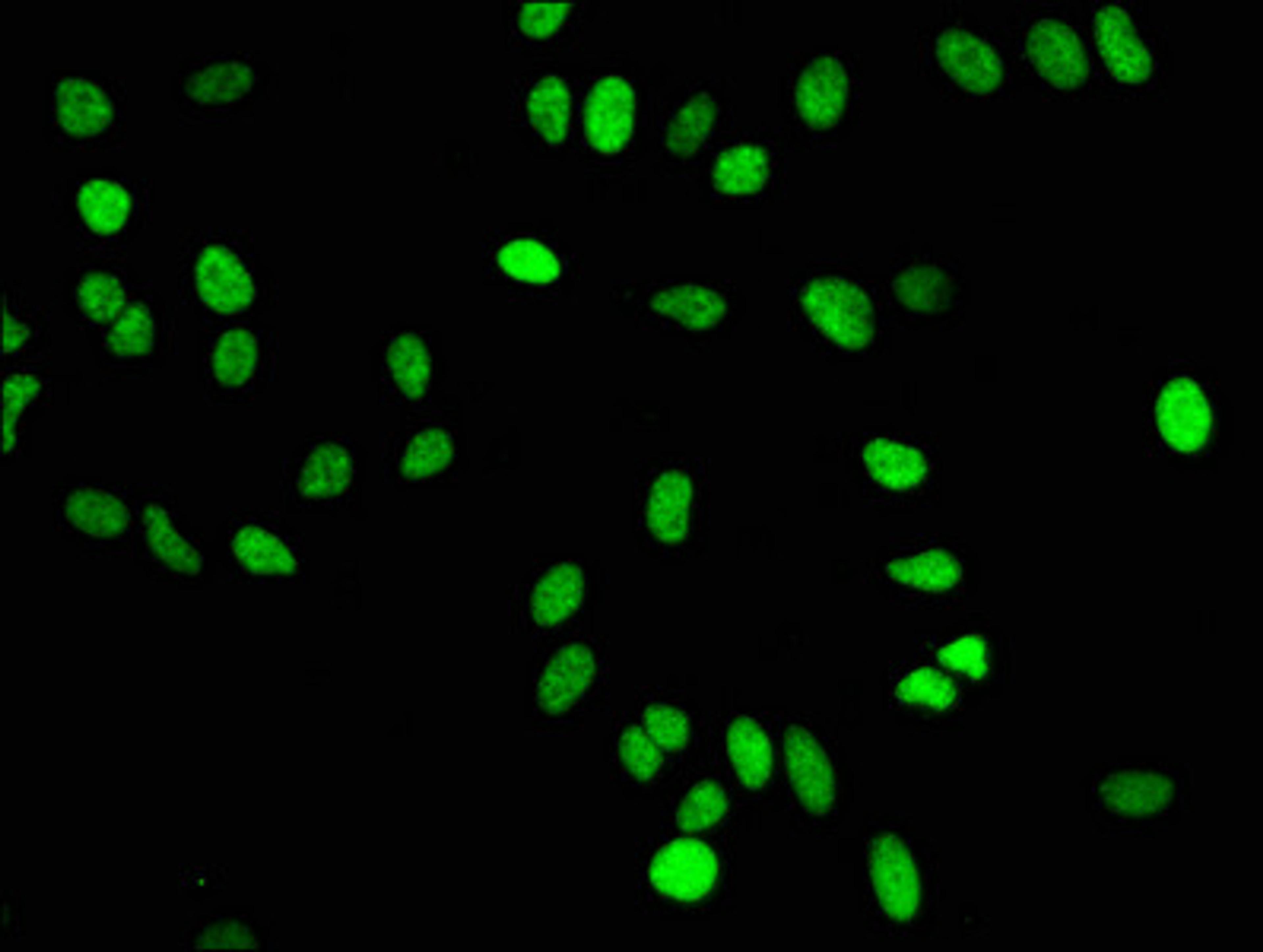 Immunofluorescence staining of Hela cells with CSB-RA010429A16me1HU at 1:50,counter-stained with DAPI. The cells were fixed in 4% formaldehyde, permeabilized using 0.2% Triton X-100 and blocked in 10% normal Goat Serum. The cells were then incubated with the antibody overnight at 4℃.The secondary antibody was Alexa Fluor 488-congugated AffiniPure Goat Anti-Rabbit IgG (H+L).